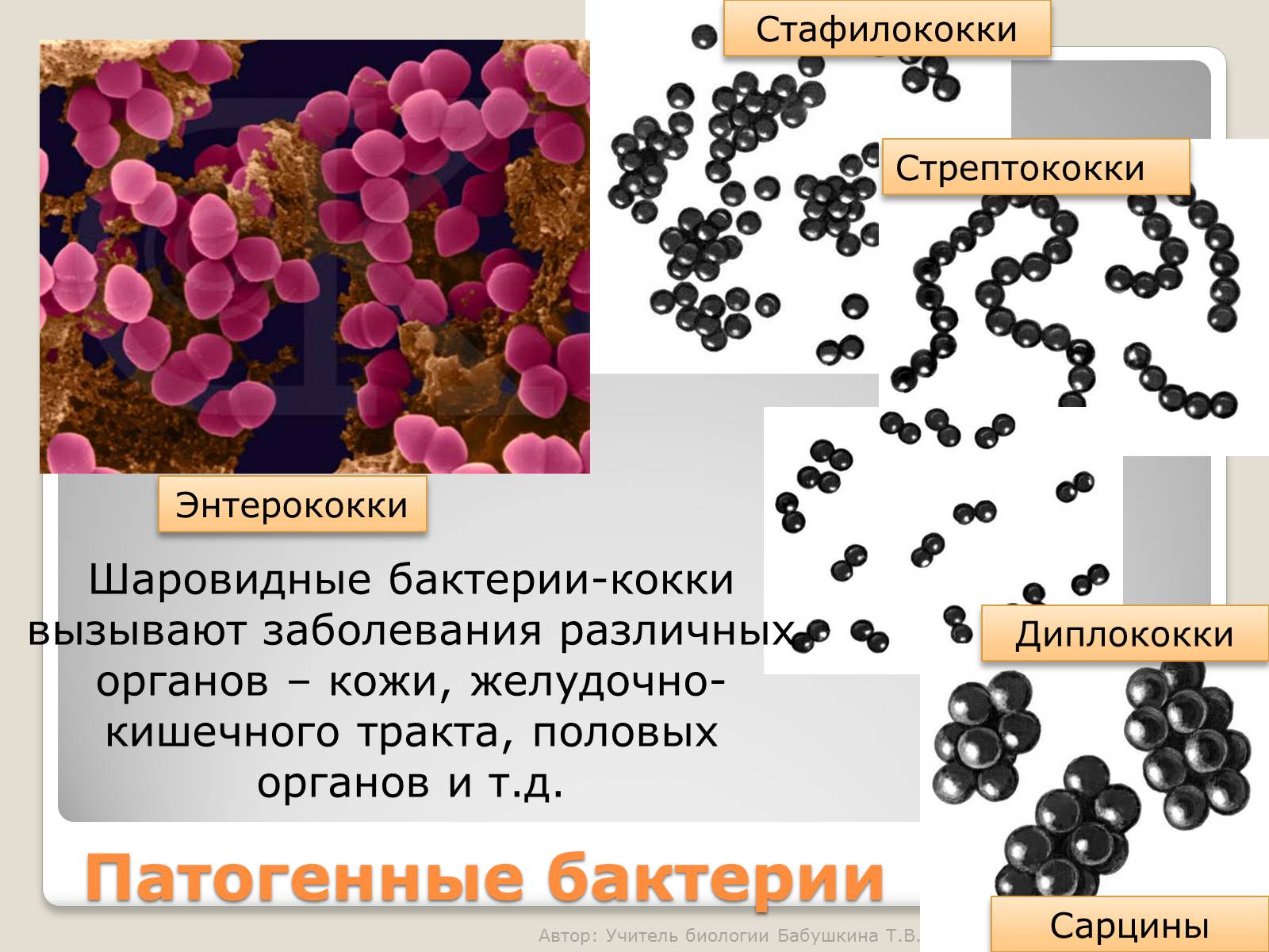 Презентація на тему «Царство Бактерии» - Слайд #18