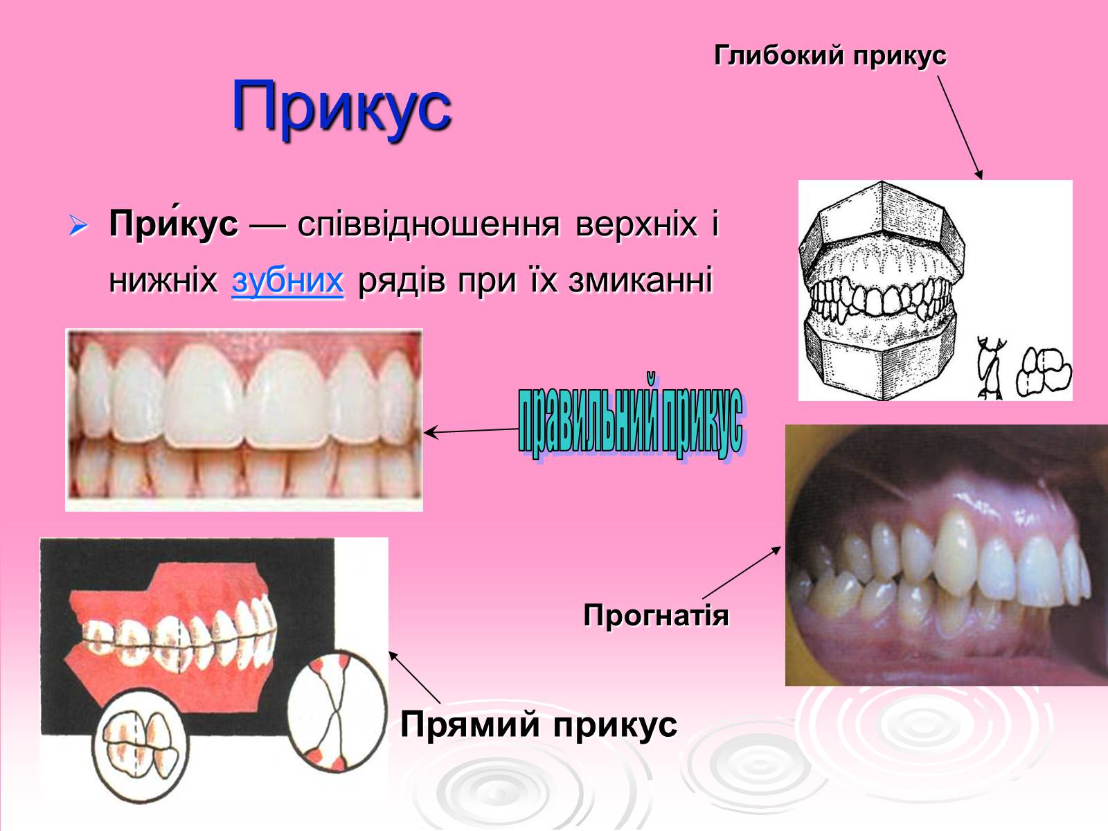 Презентація на тему «Зуби» (варіант 3) - Слайд #7