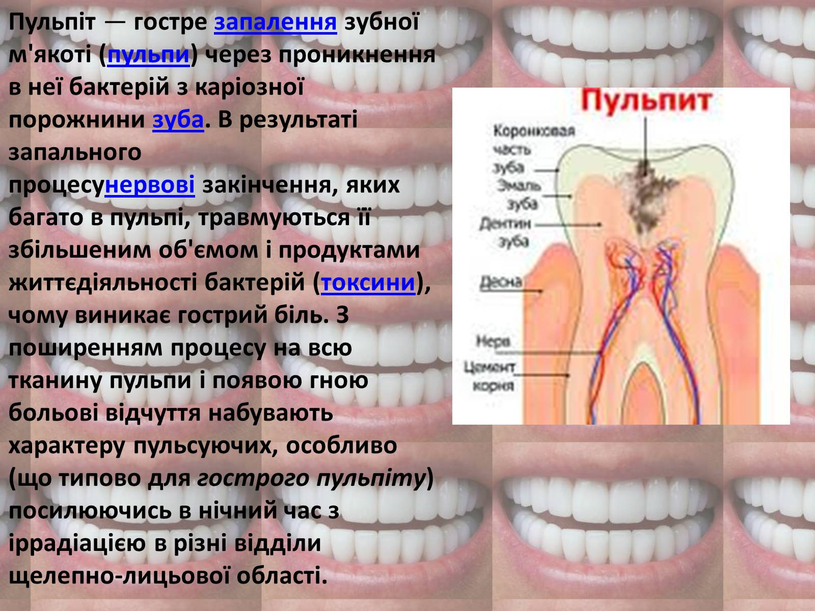Презентація на тему «Зуби» (варіант 2) - Слайд #8
