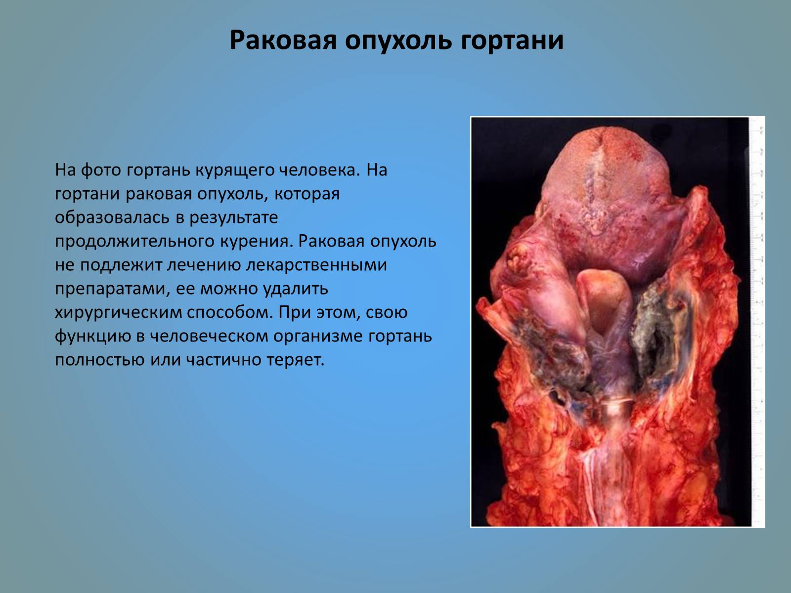 Презентація на тему «Воздействие вредных веществ на организм человека» - Слайд #41