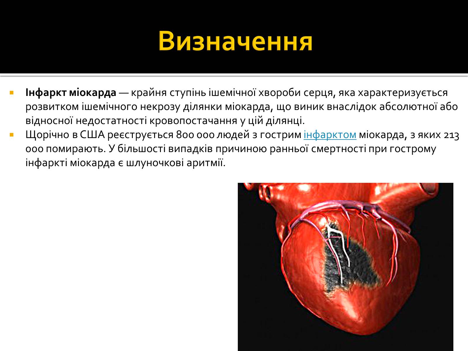 Презентація на тему «Інфаркт міокарда» (варіант 1) - Слайд #2