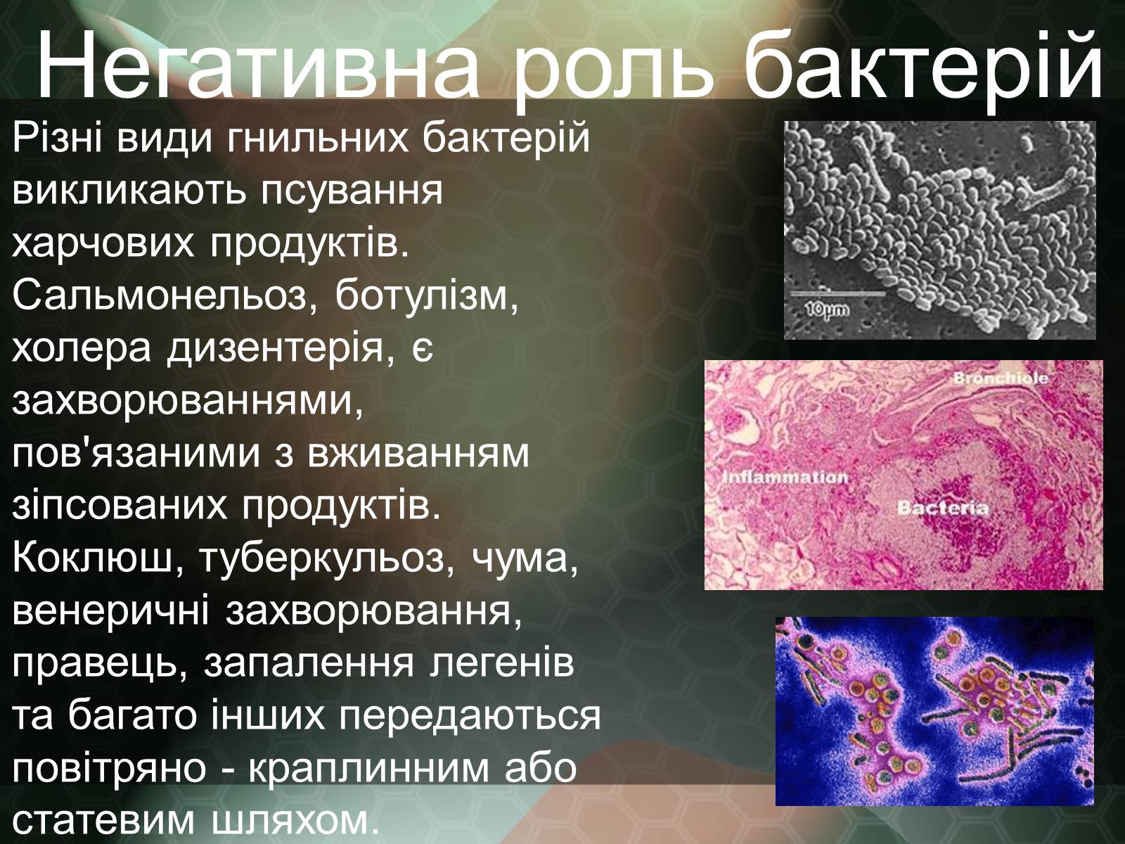 Презентація на тему «Прокаріотична клітина» - Слайд #19
