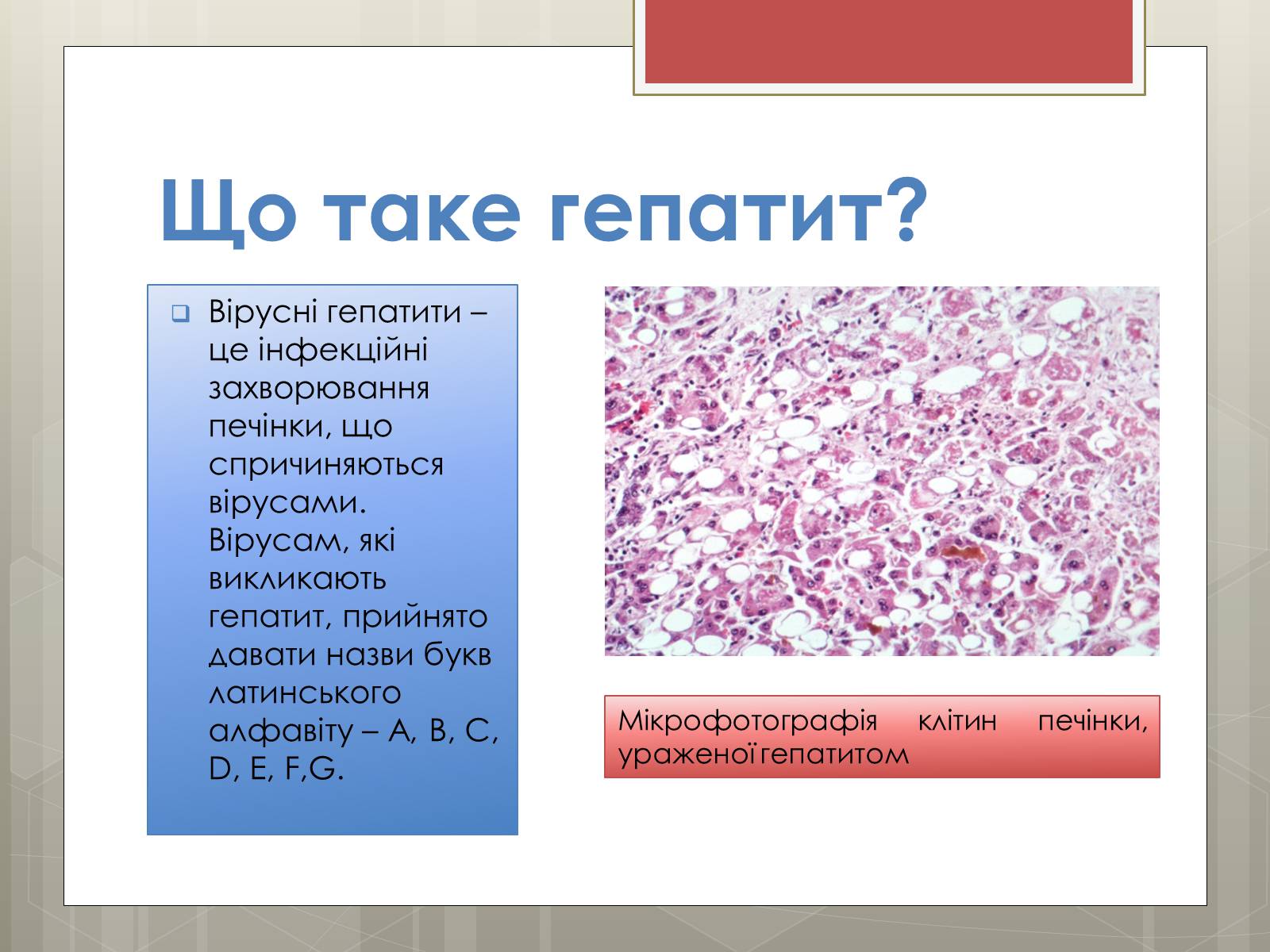 Презентація на тему «Вірусні гепатити» (варіант 1) - Слайд #2
