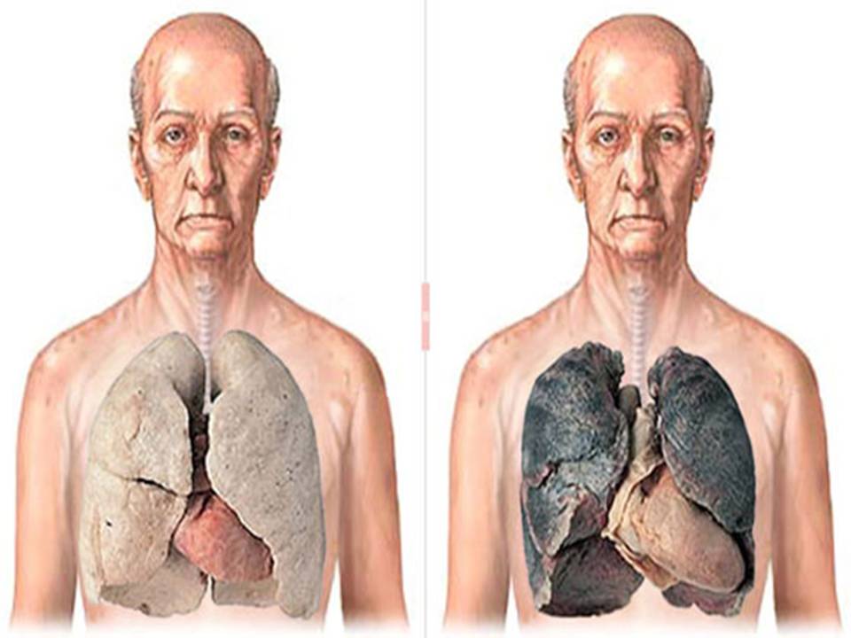 Презентація на тему «Влияние курения на организм человека» - Слайд #4