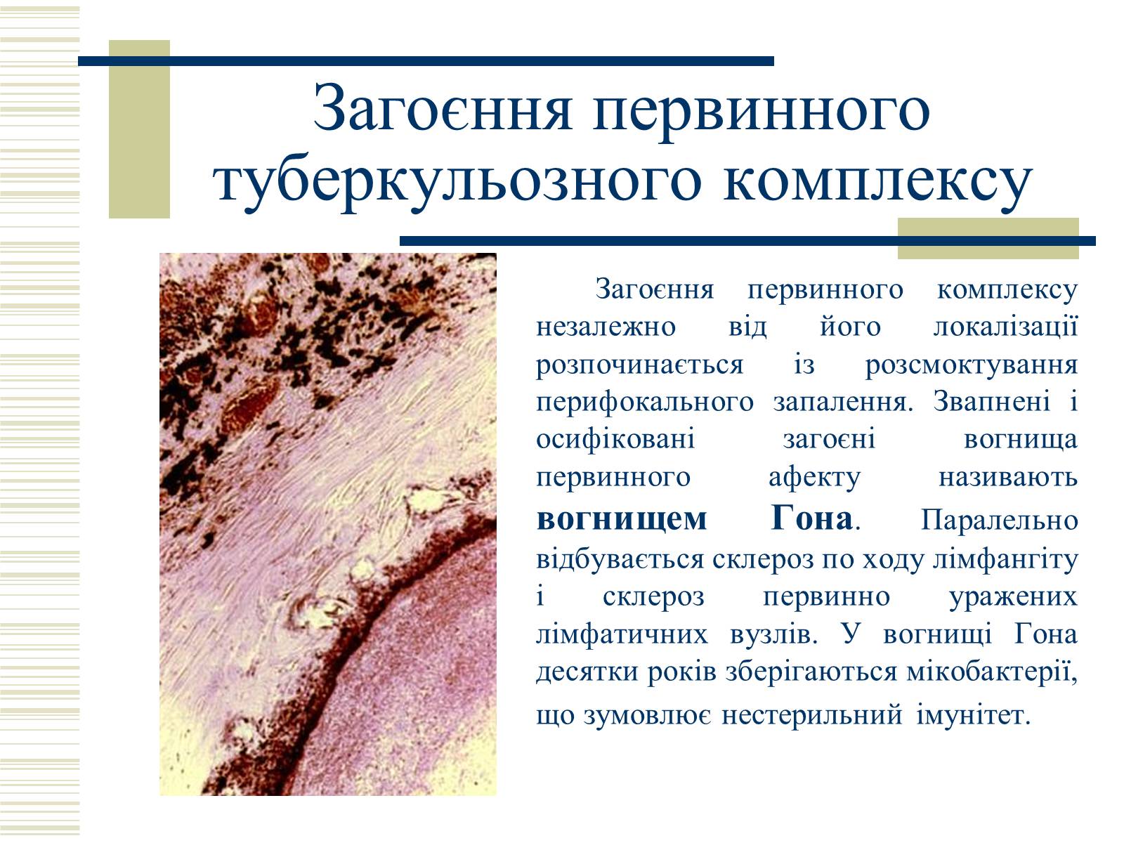 Презентація на тему «Патологічна анатомія туберкульозу» - Слайд #9