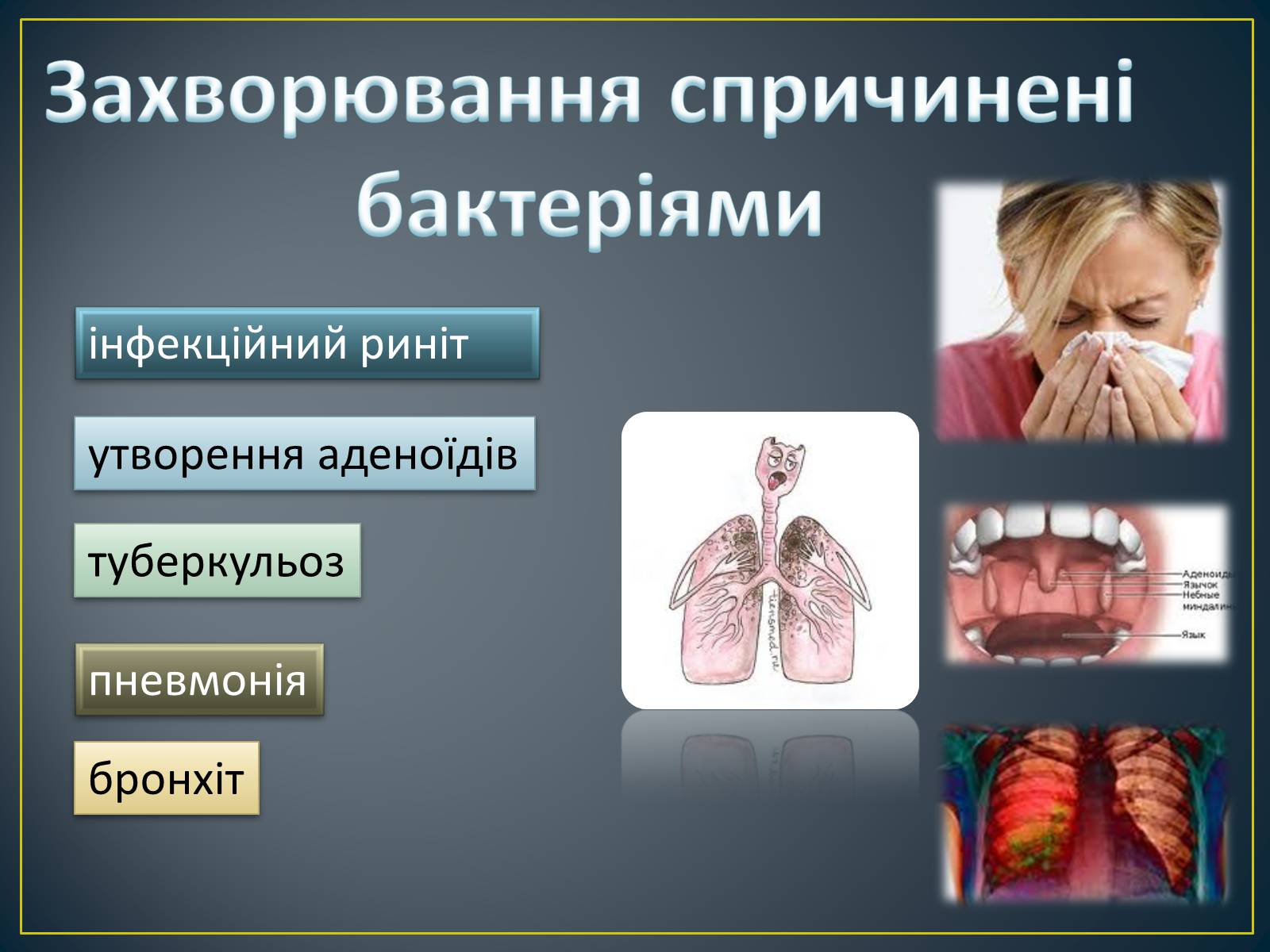 Презентація на тему «Захворювання органів дихання» - Слайд #6