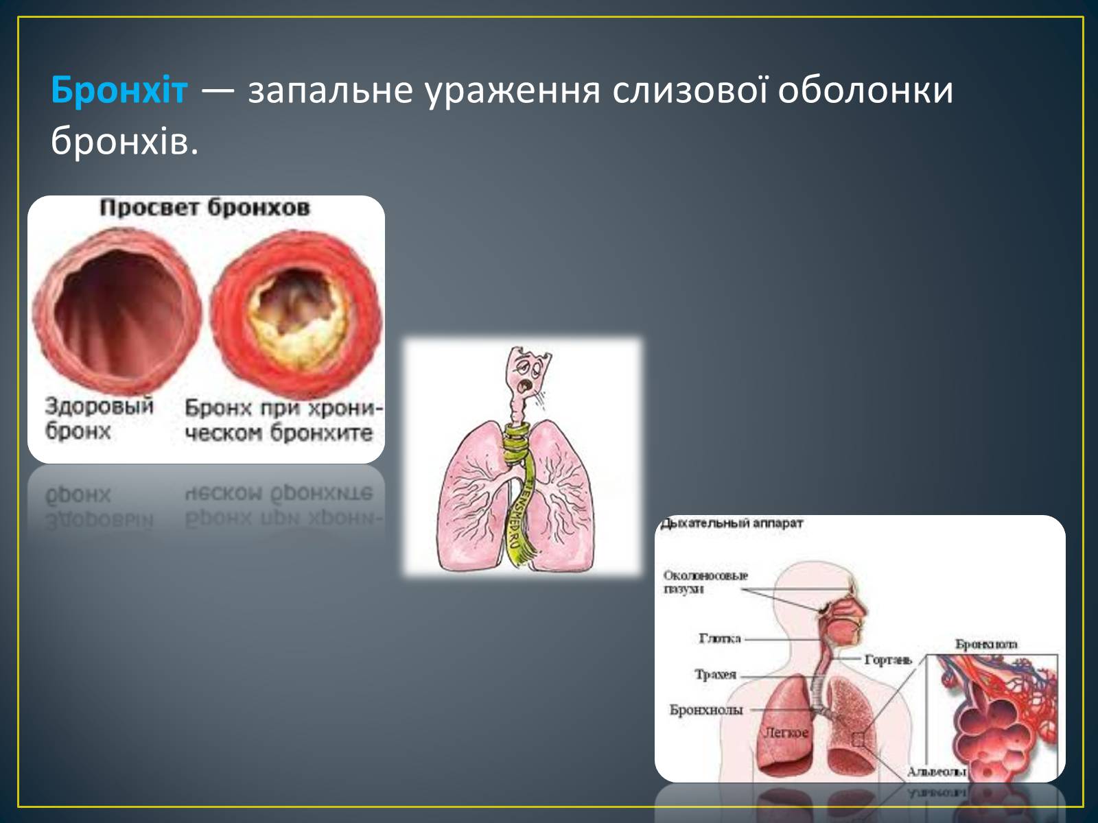 Презентація на тему «Захворювання органів дихання» - Слайд #11