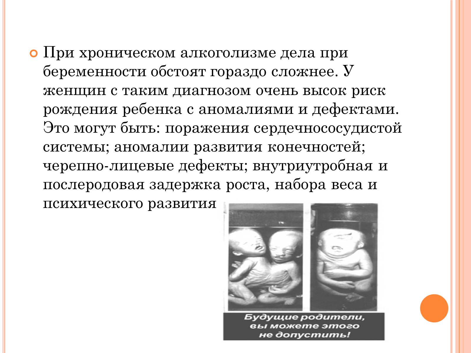 Презентація на тему «Беременность и алкоголь» - Слайд #19
