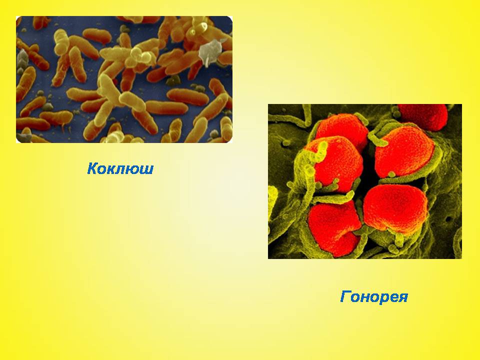 Презентація на тему «Бактериальные заболевания и их профилактика» - Слайд #5