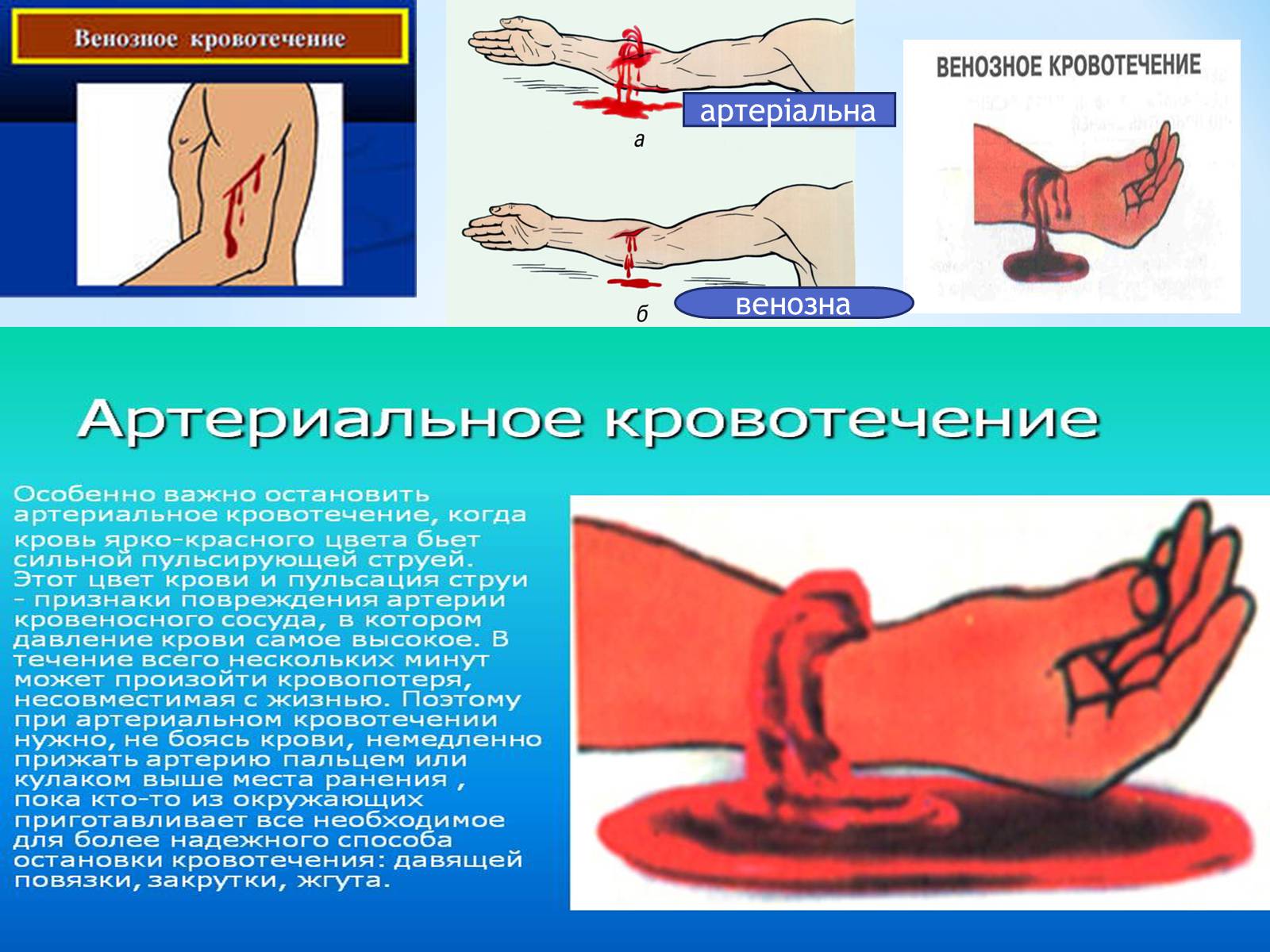 Презентація на тему «Кровоносна система» (варіант 1) - Слайд #23