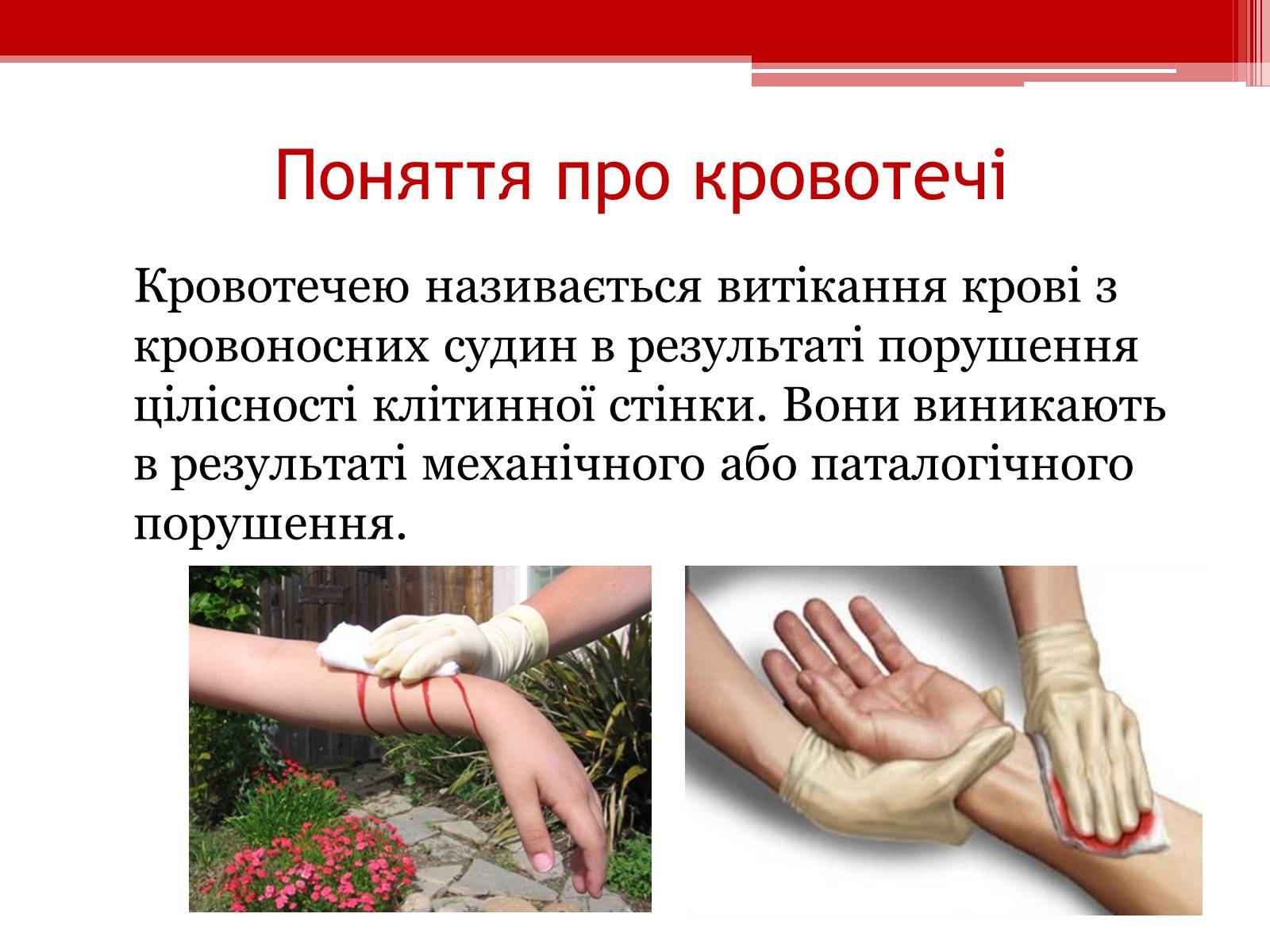 Презентація на тему «Перша допомога при кровотечах» (варіант 1) - Слайд #2