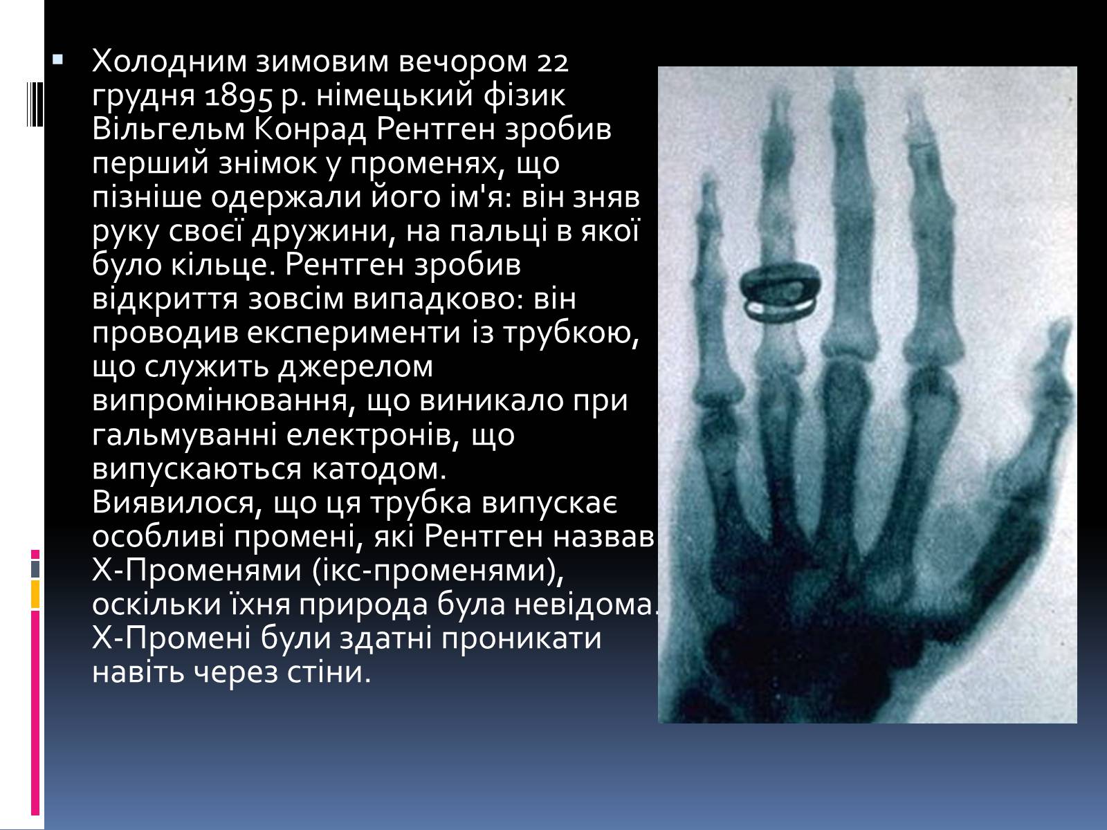 Презентація на тему «Рентгенівське випромінювання» (варіант 1) - Слайд #3