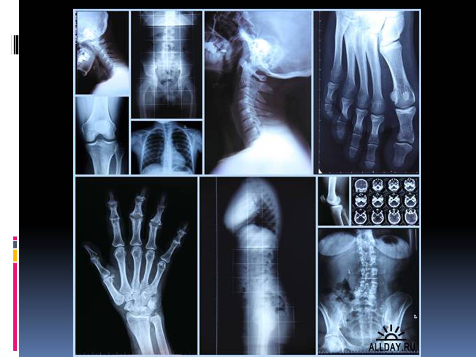 Презентація на тему «Рентгенівське випромінювання» (варіант 1) - Слайд #7