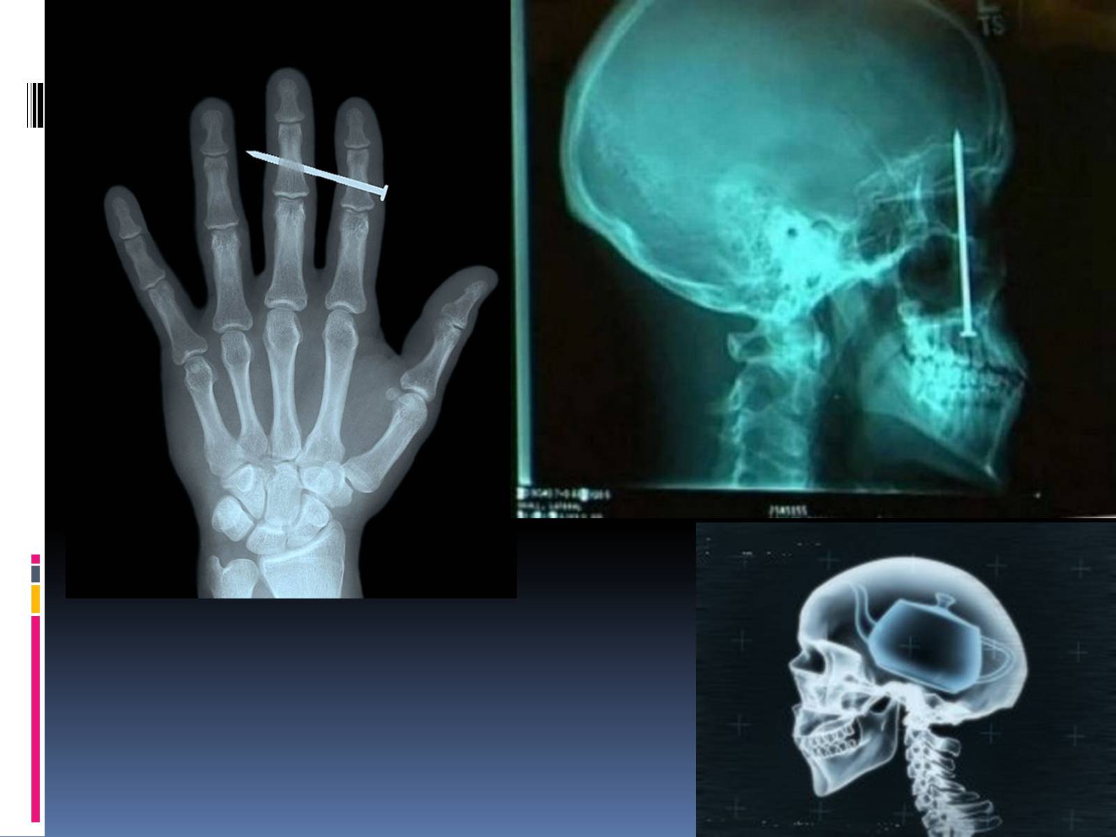 Презентація на тему «Рентгенівське випромінювання» (варіант 1) - Слайд #9