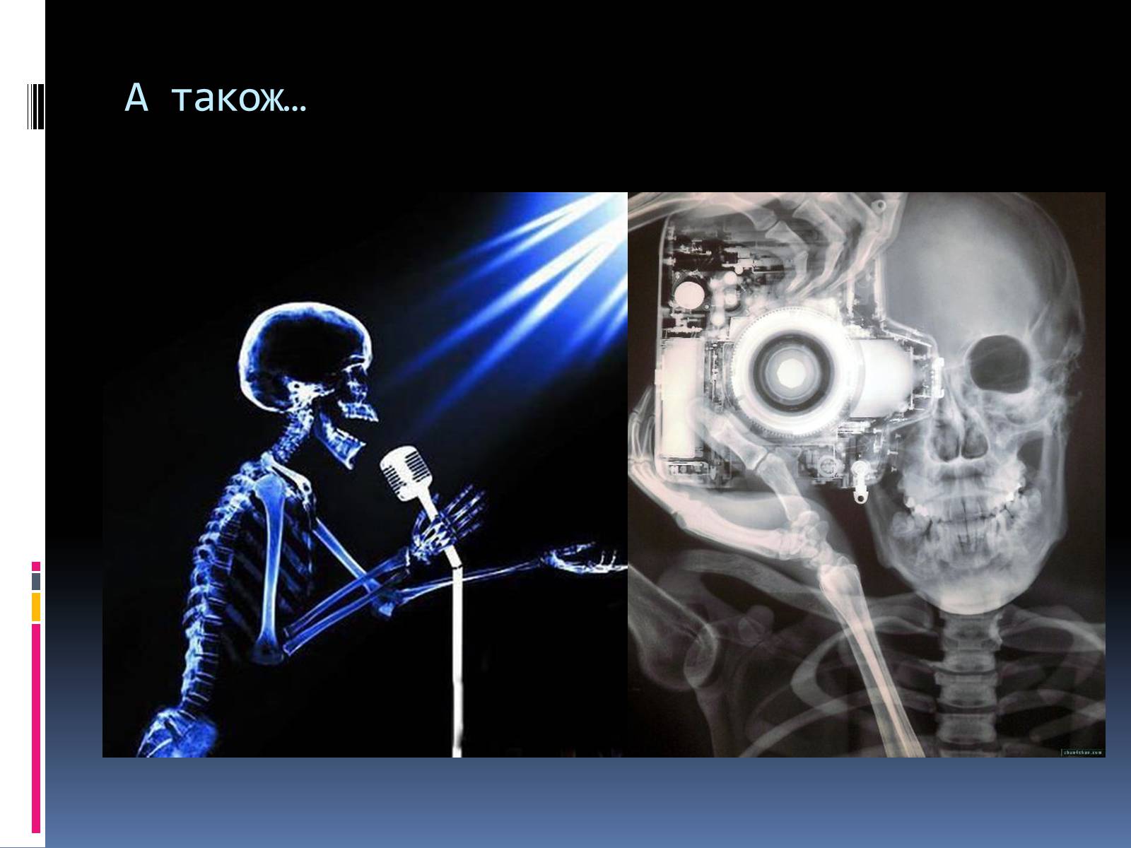 Презентація на тему «Рентгенівське випромінювання» (варіант 1) - Слайд #13