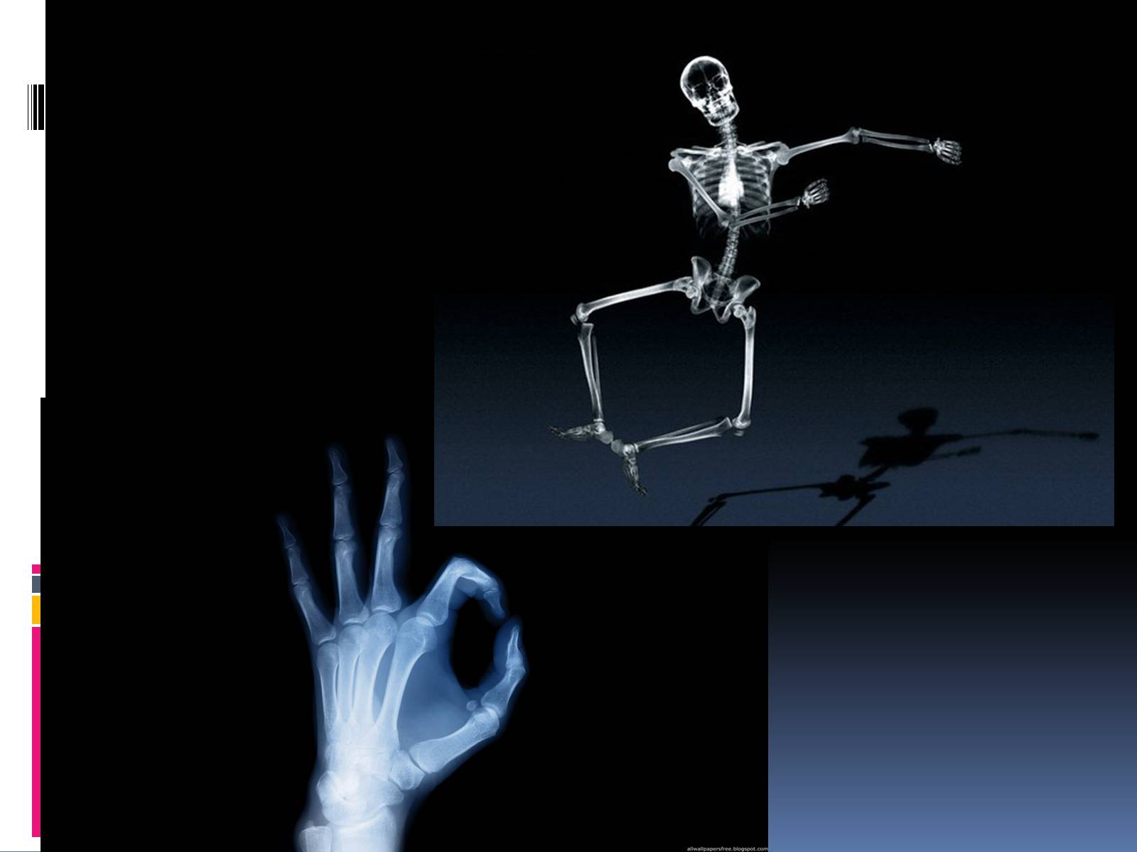 Презентація на тему «Рентгенівське випромінювання» (варіант 1) - Слайд #18
