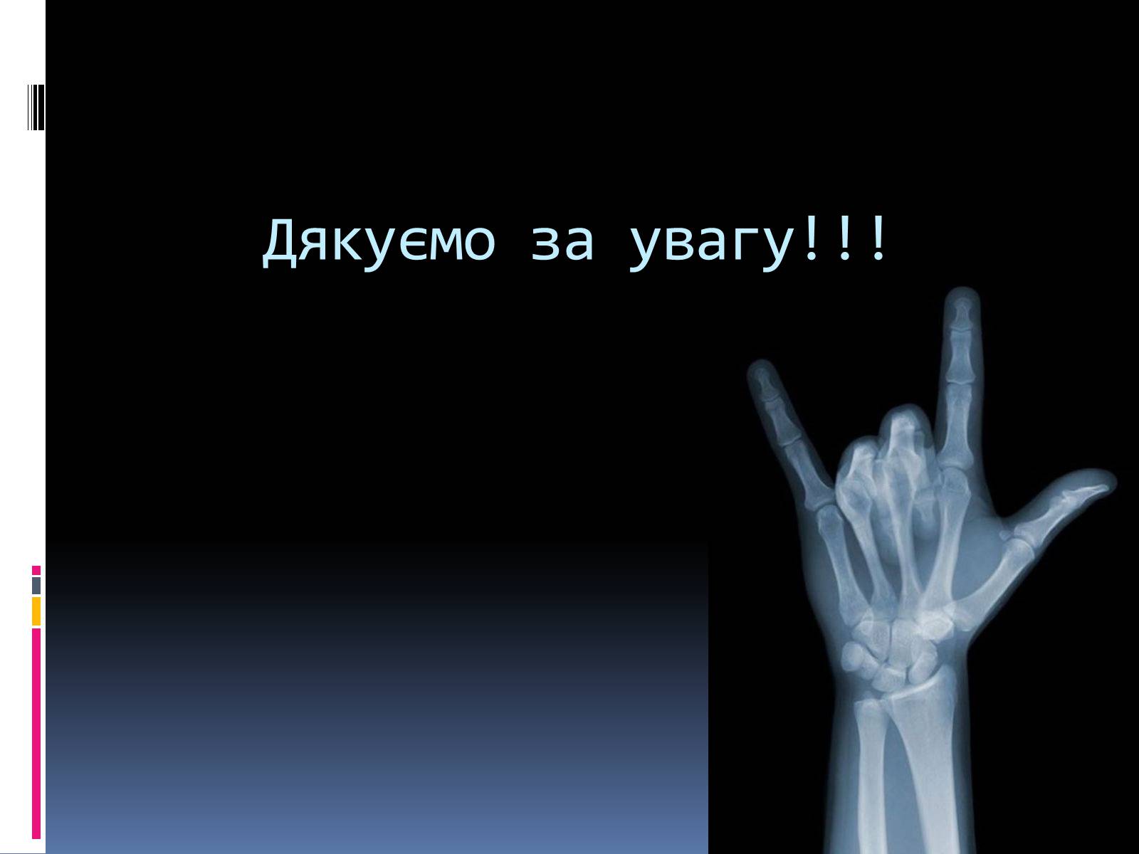 Презентація на тему «Рентгенівське випромінювання» (варіант 1) - Слайд #19