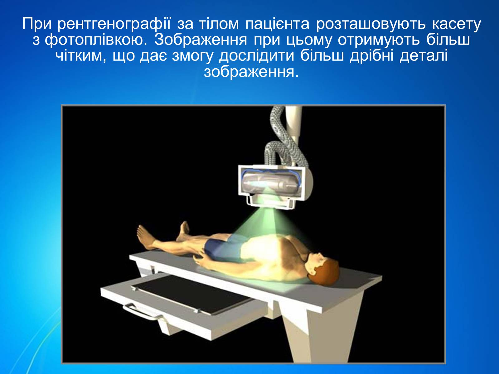 Презентація на тему «Рентгенівське випромінювання» (варіант 7) - Слайд #11