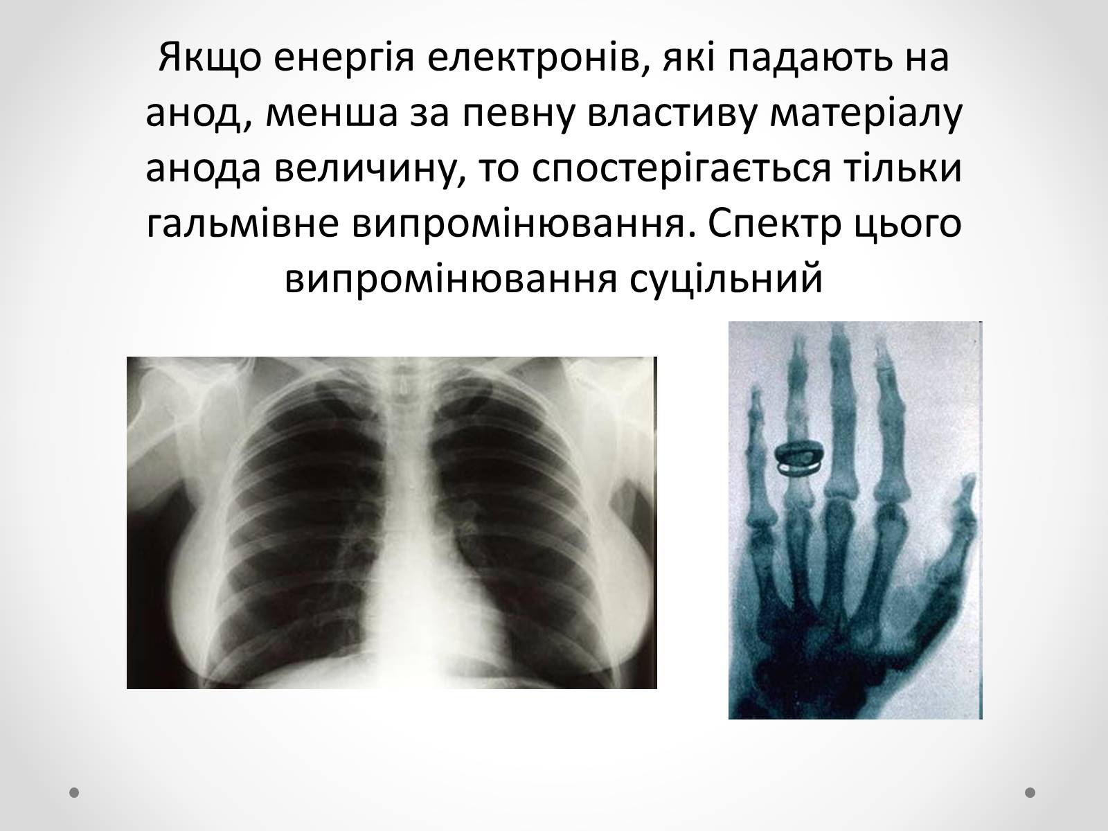 Презентація на тему «Рентгенівське випромінювання» (варіант 8) - Слайд #8