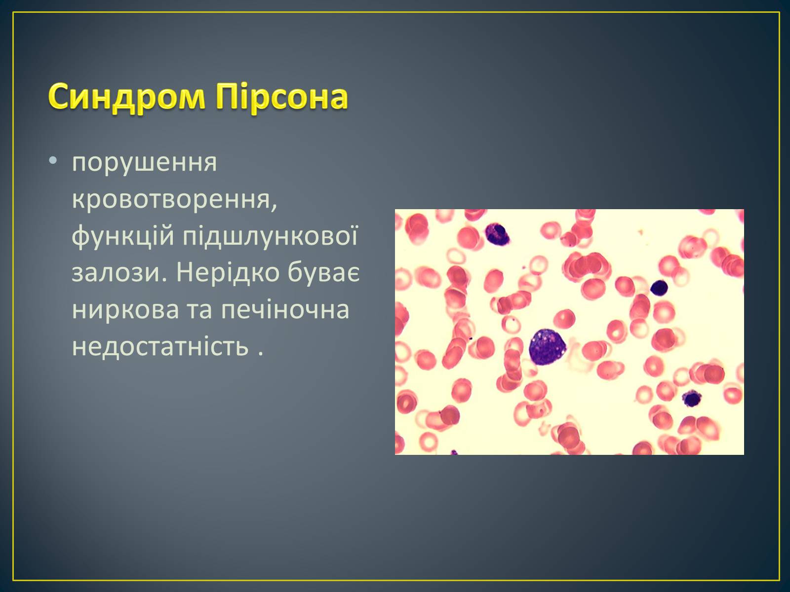 Презентація на тему «Типи генетичних хвороб людини» (варіант 1) - Слайд #17