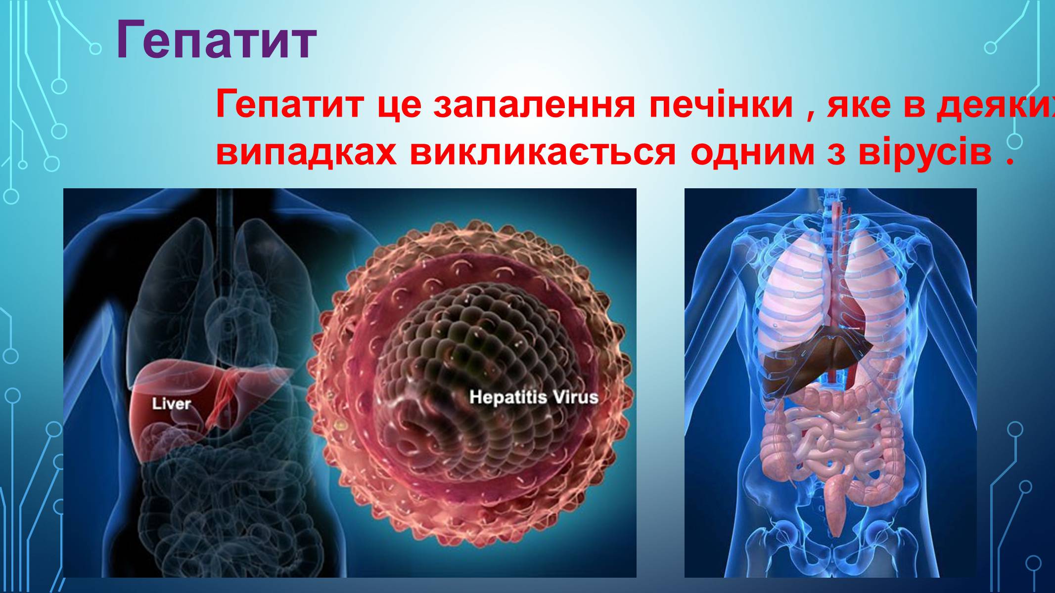 Презентація на тему «Гепатит» (варіант 2) - Слайд #2