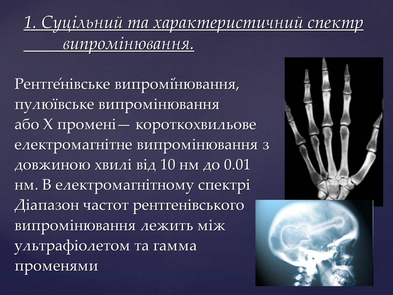 Презентація на тему «Рентгенівське випромінювання» (варіант 2) - Слайд #3