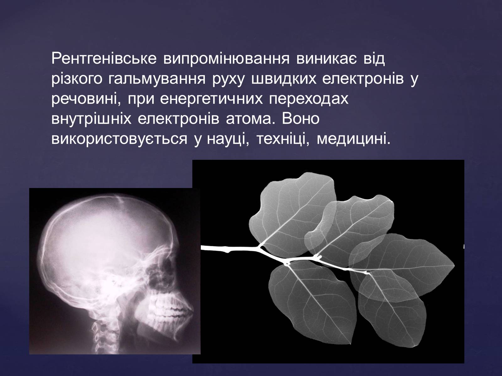 Презентація на тему «Рентгенівське випромінювання» (варіант 2) - Слайд #4