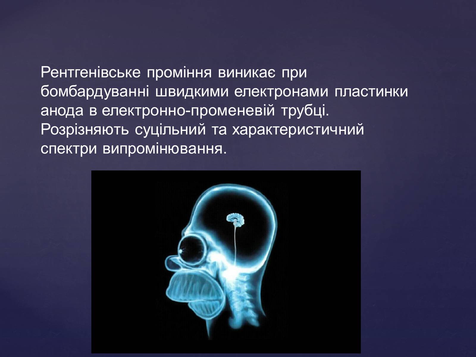Презентація на тему «Рентгенівське випромінювання» (варіант 2) - Слайд #8
