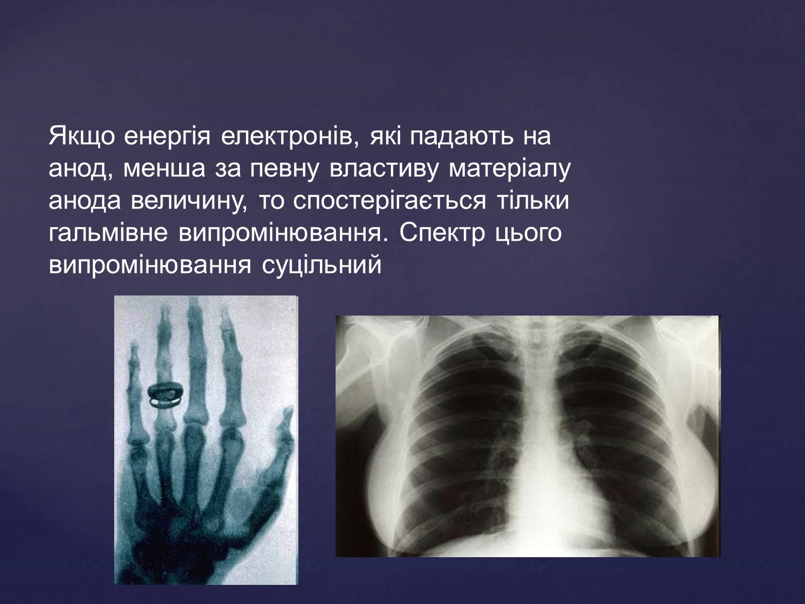 Презентація на тему «Рентгенівське випромінювання» (варіант 2) - Слайд #9