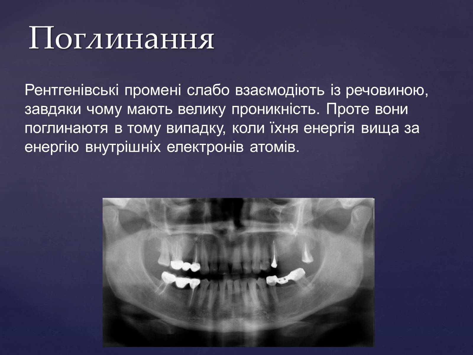 Презентація на тему «Рентгенівське випромінювання» (варіант 2) - Слайд #11