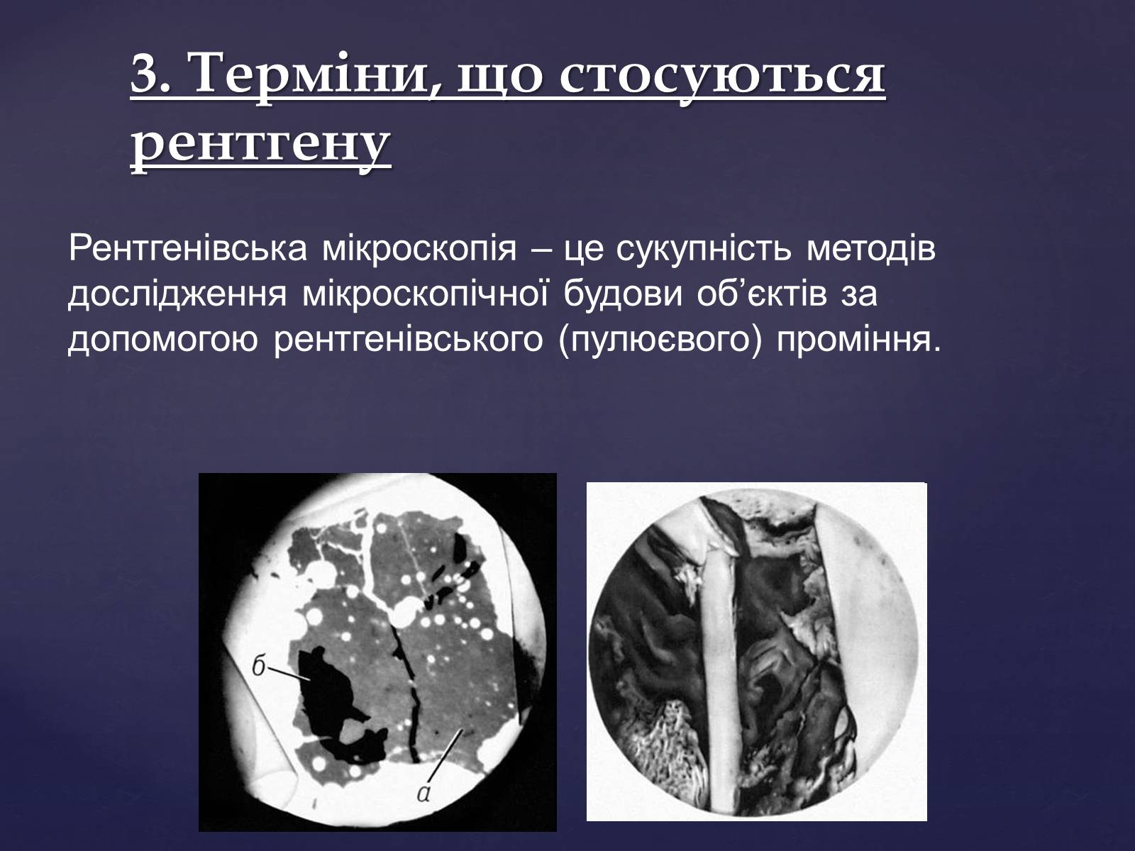 Презентація на тему «Рентгенівське випромінювання» (варіант 2) - Слайд #15