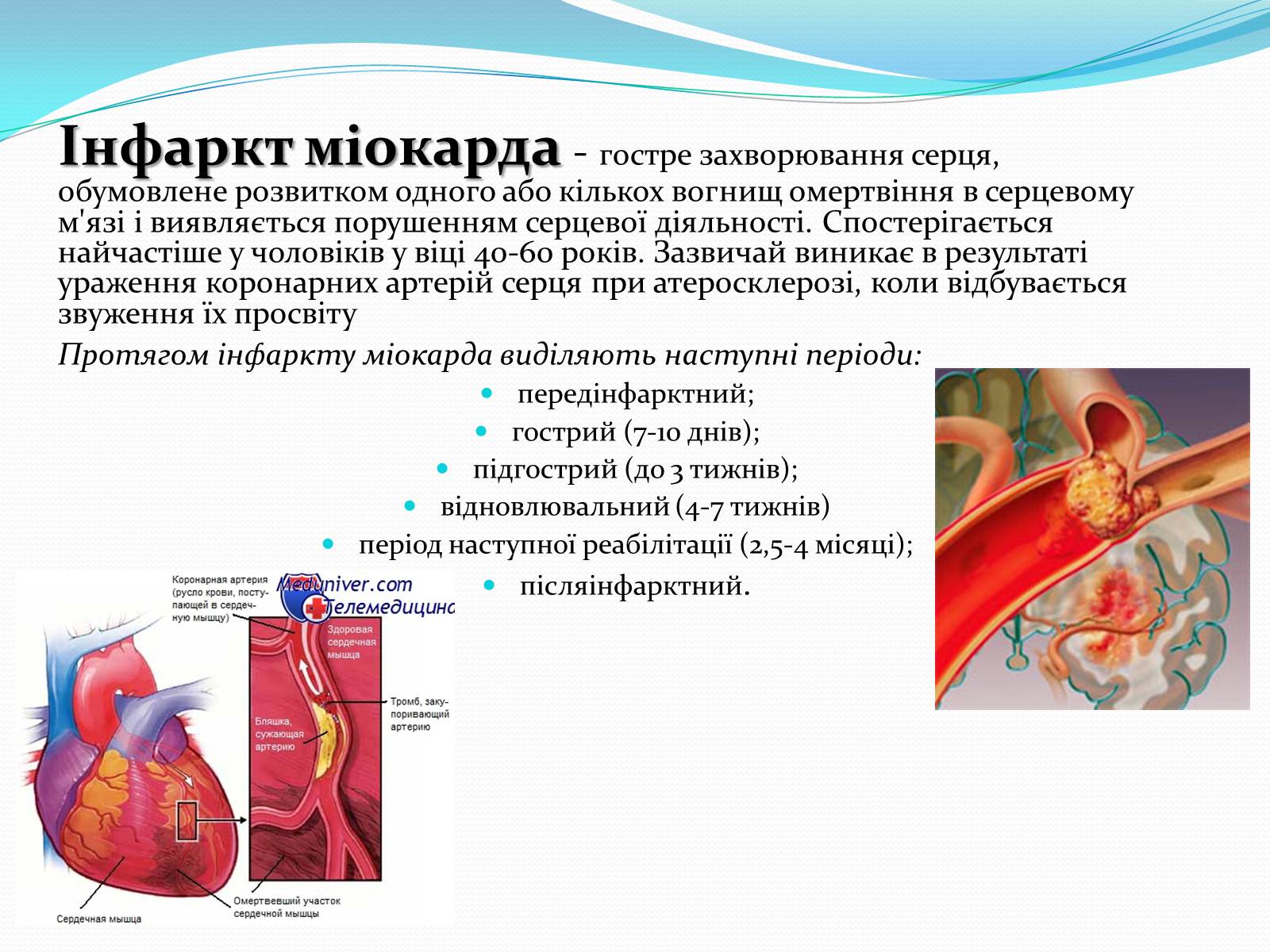 Презентація на тему «Серцево-судинні захворювання» - Слайд #5