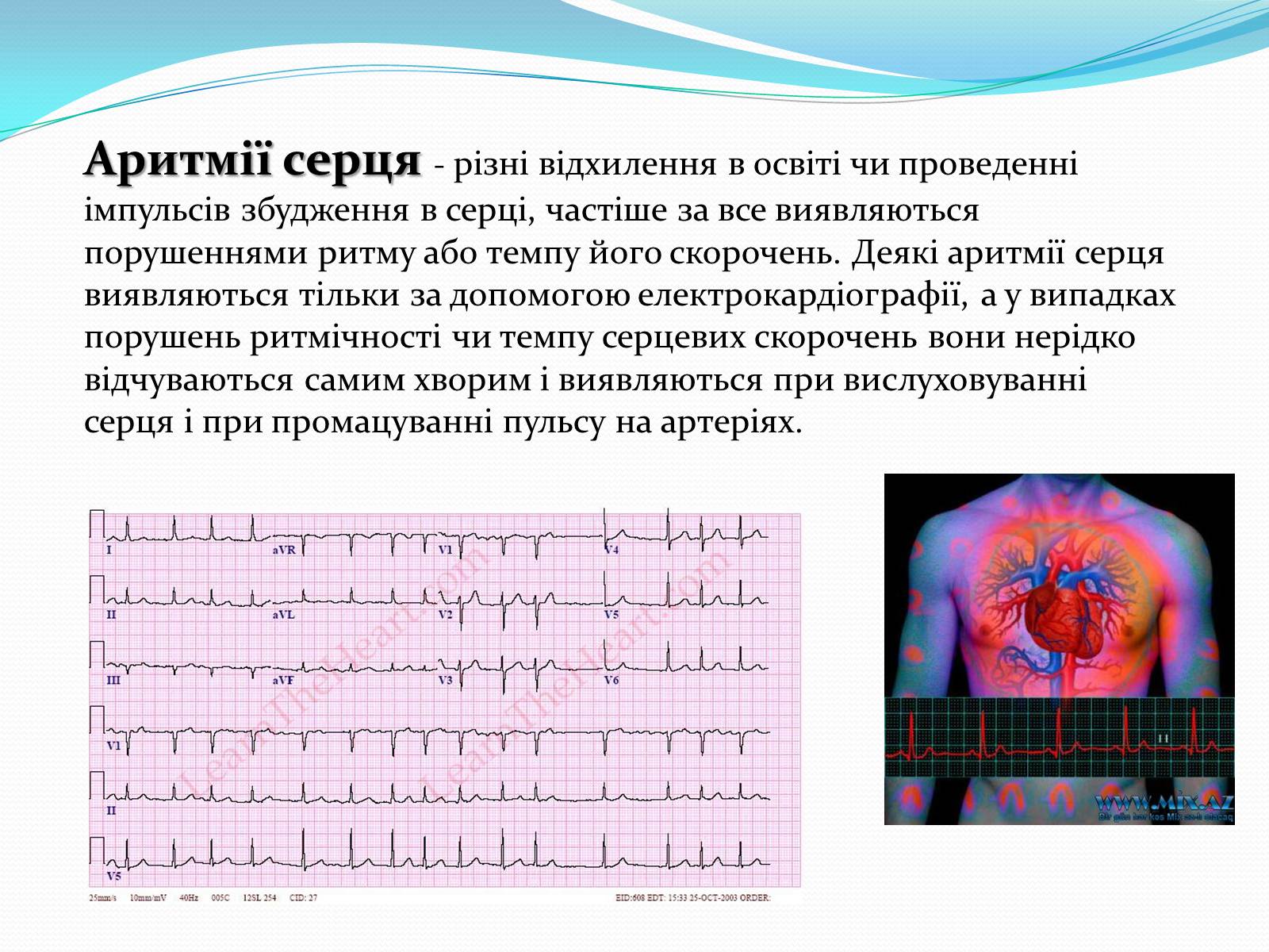 Презентація на тему «Серцево-судинні захворювання» - Слайд #6