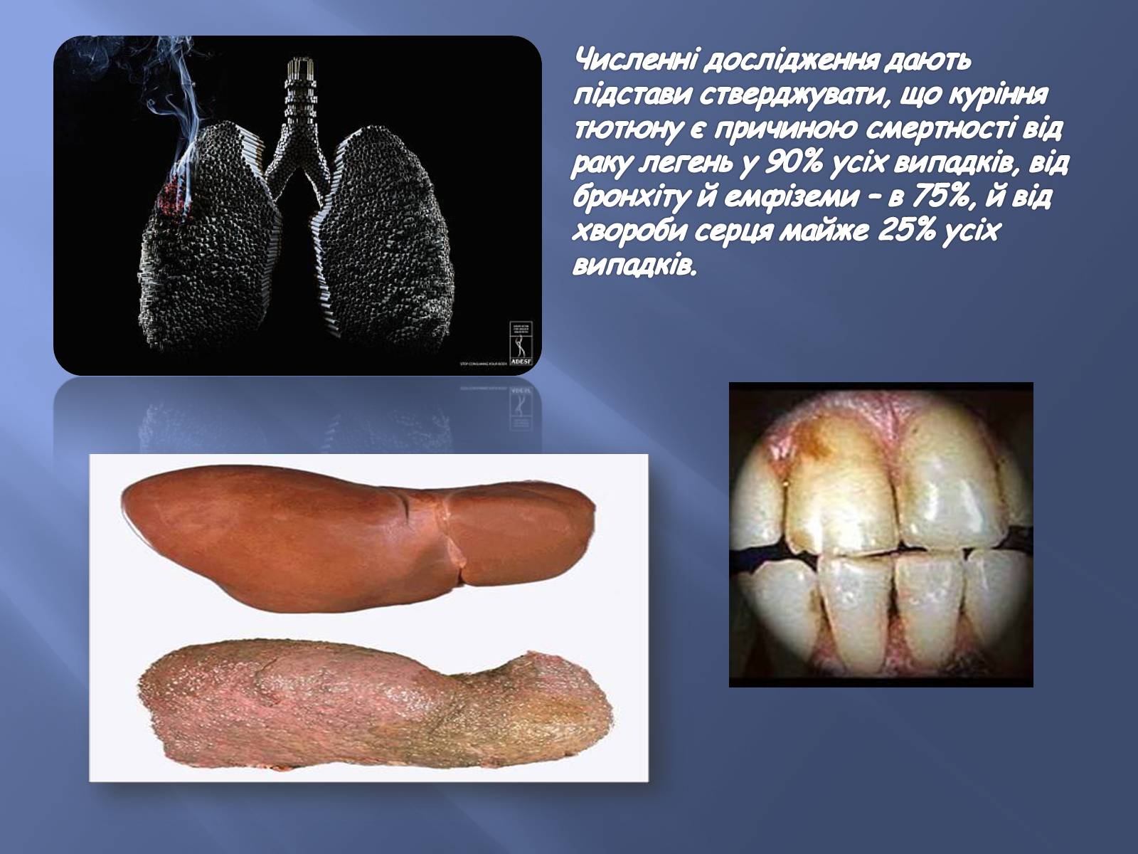 Презентація на тему «Тютюнопаління та його шкідливі наслідки» - Слайд #6