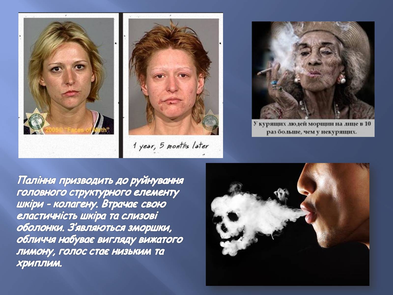 Презентація на тему «Тютюнопаління та його шкідливі наслідки» - Слайд #8