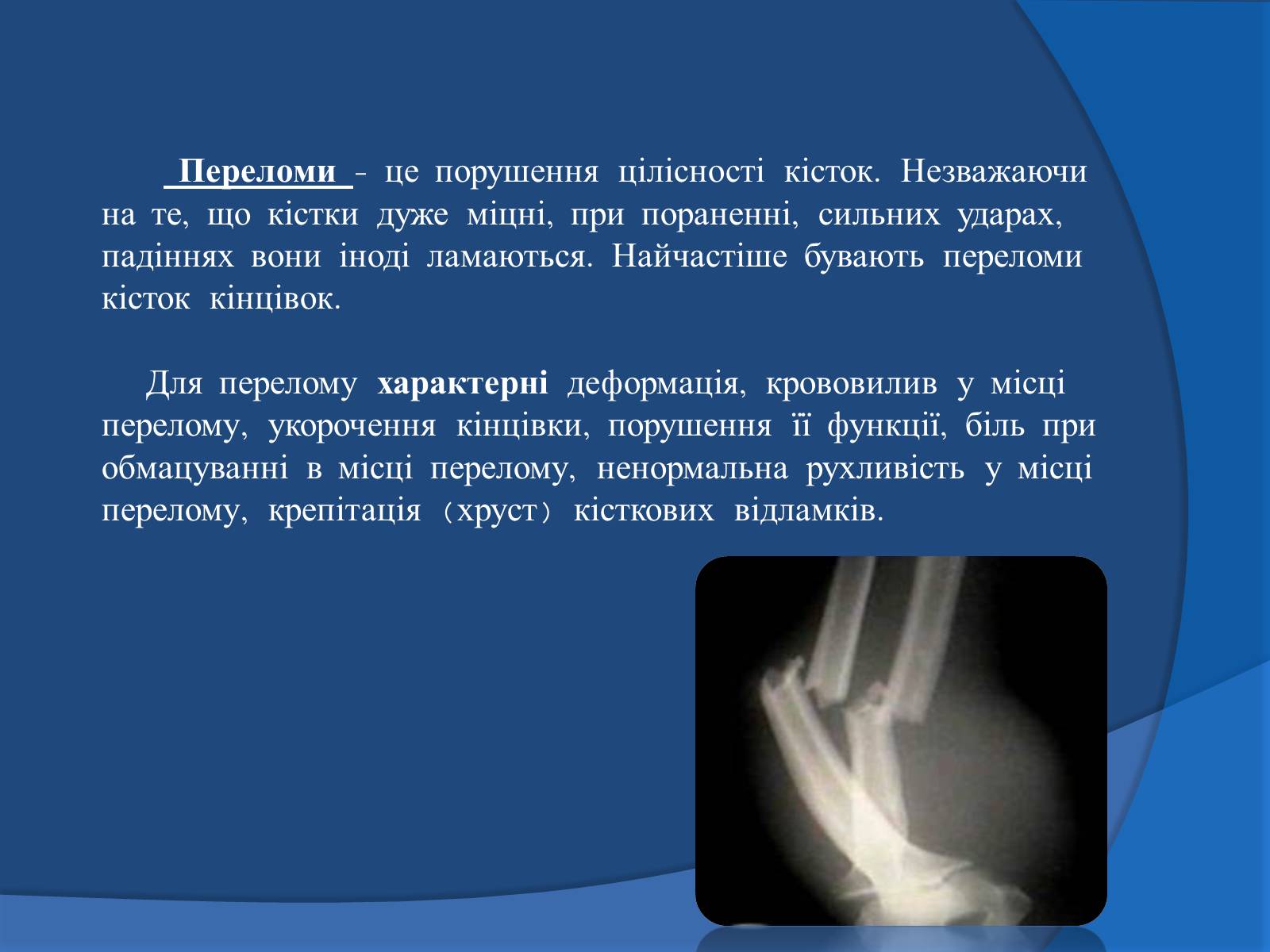 Презентація на тему «Травми кісток та суглобів» - Слайд #9