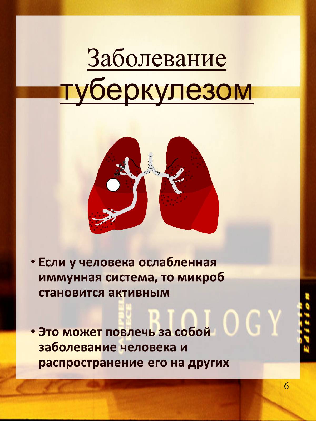 Презентація на тему «Туберкулез» (варіант 2) - Слайд #7