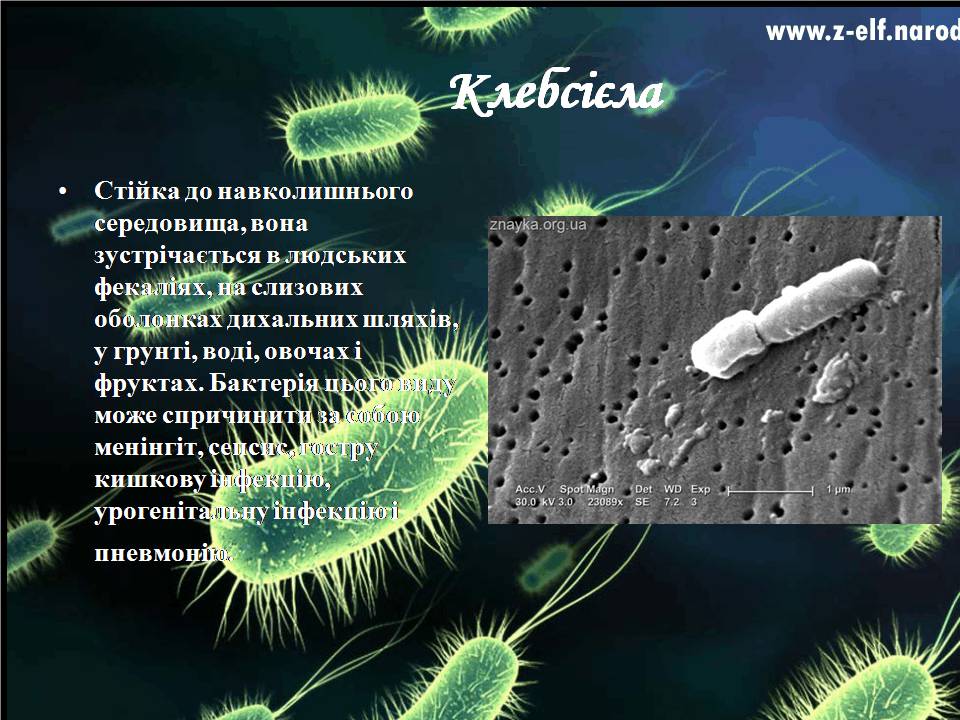 Презентація на тему «Бактерії» (варіант 4) - Слайд #12