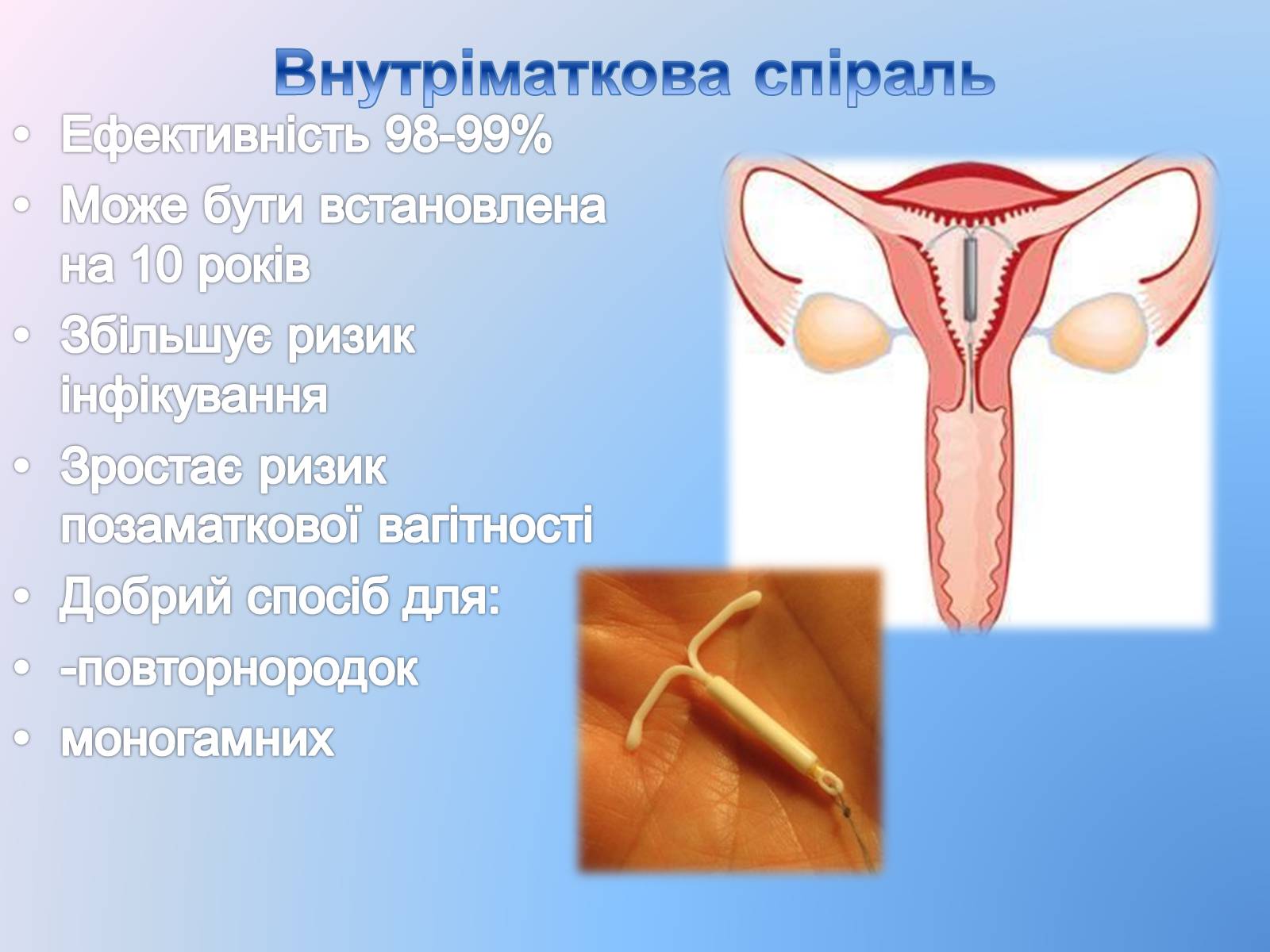 Презентація на тему «Контрацепція» (варіант 3) - Слайд #11