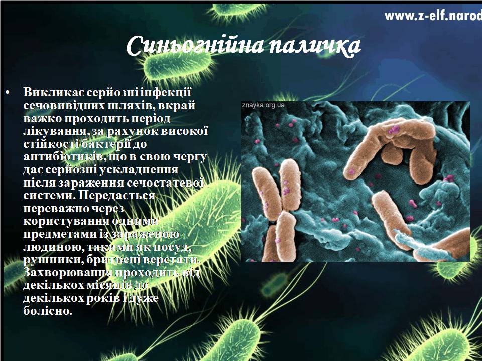 Презентація на тему «Бактерії» (варіант 4) - Слайд #13