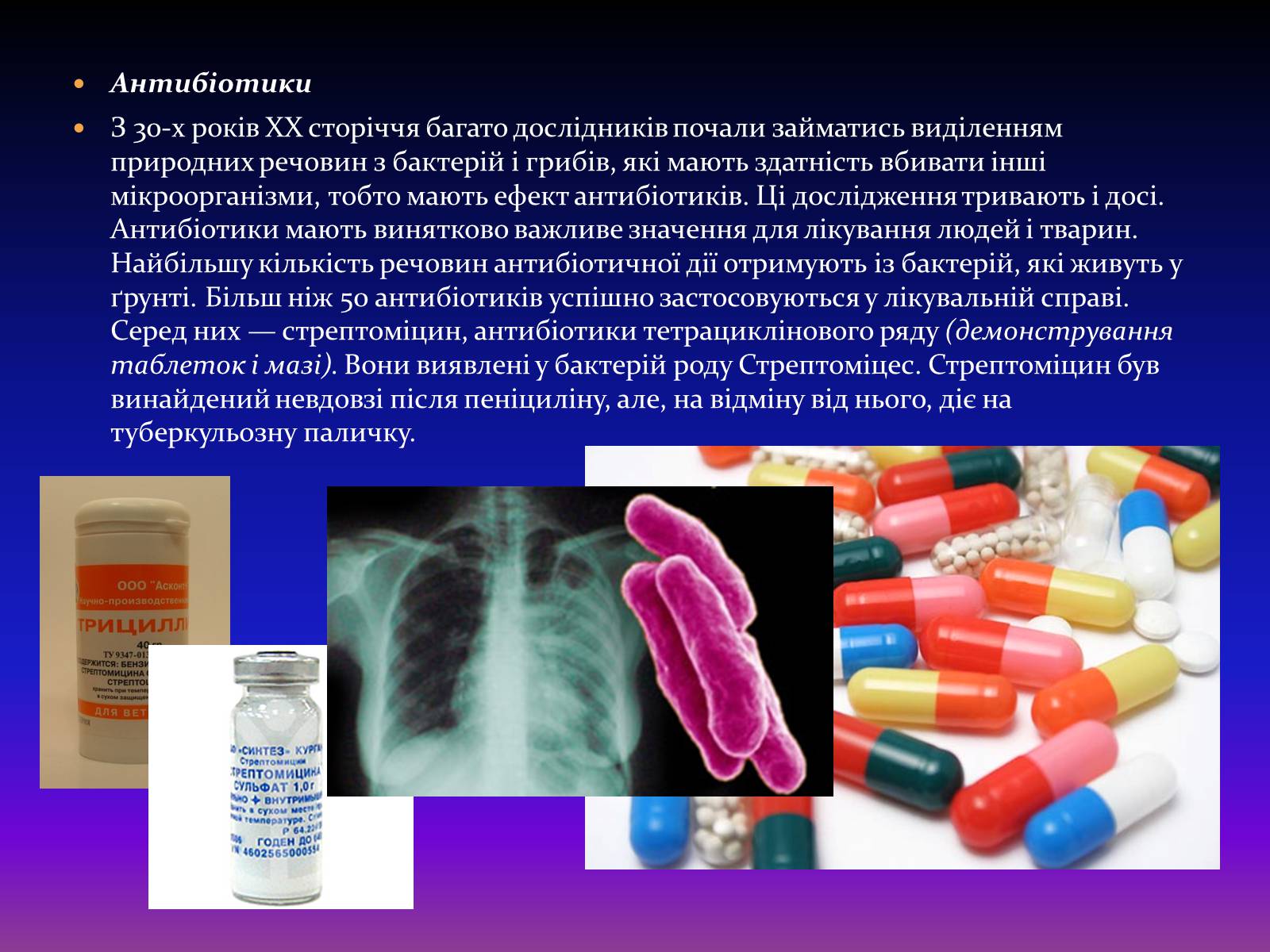 Презентація на тему «Корисні бактерії» (варіант 2) - Слайд #15