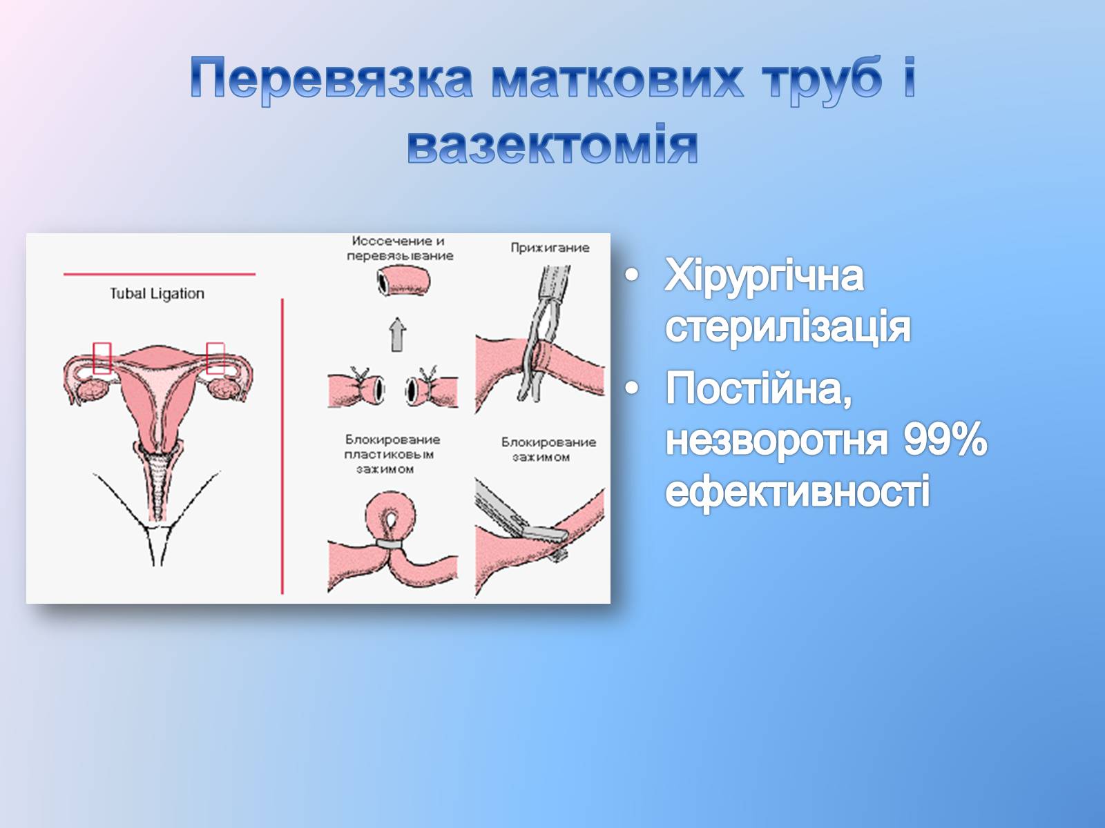 Презентація на тему «Контрацепція» (варіант 3) - Слайд #23