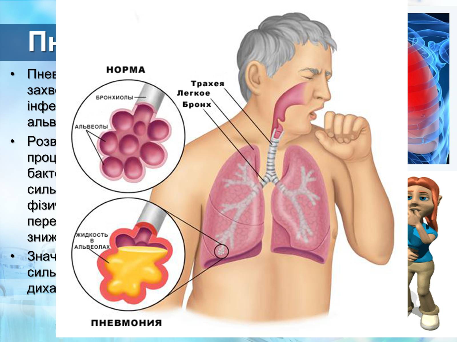 Презентація на тему «Захворювання дихальної системи. Бронхіт. Пневмонія. Астма» - Слайд #5