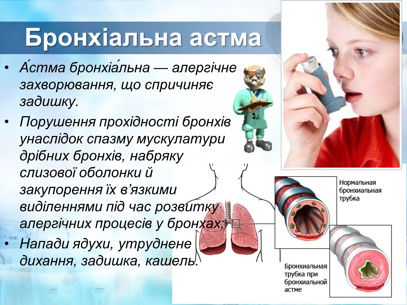 Презентація на тему «Захворювання дихальної системи. Бронхіт. Пневмонія. Астма» - Слайд #7
