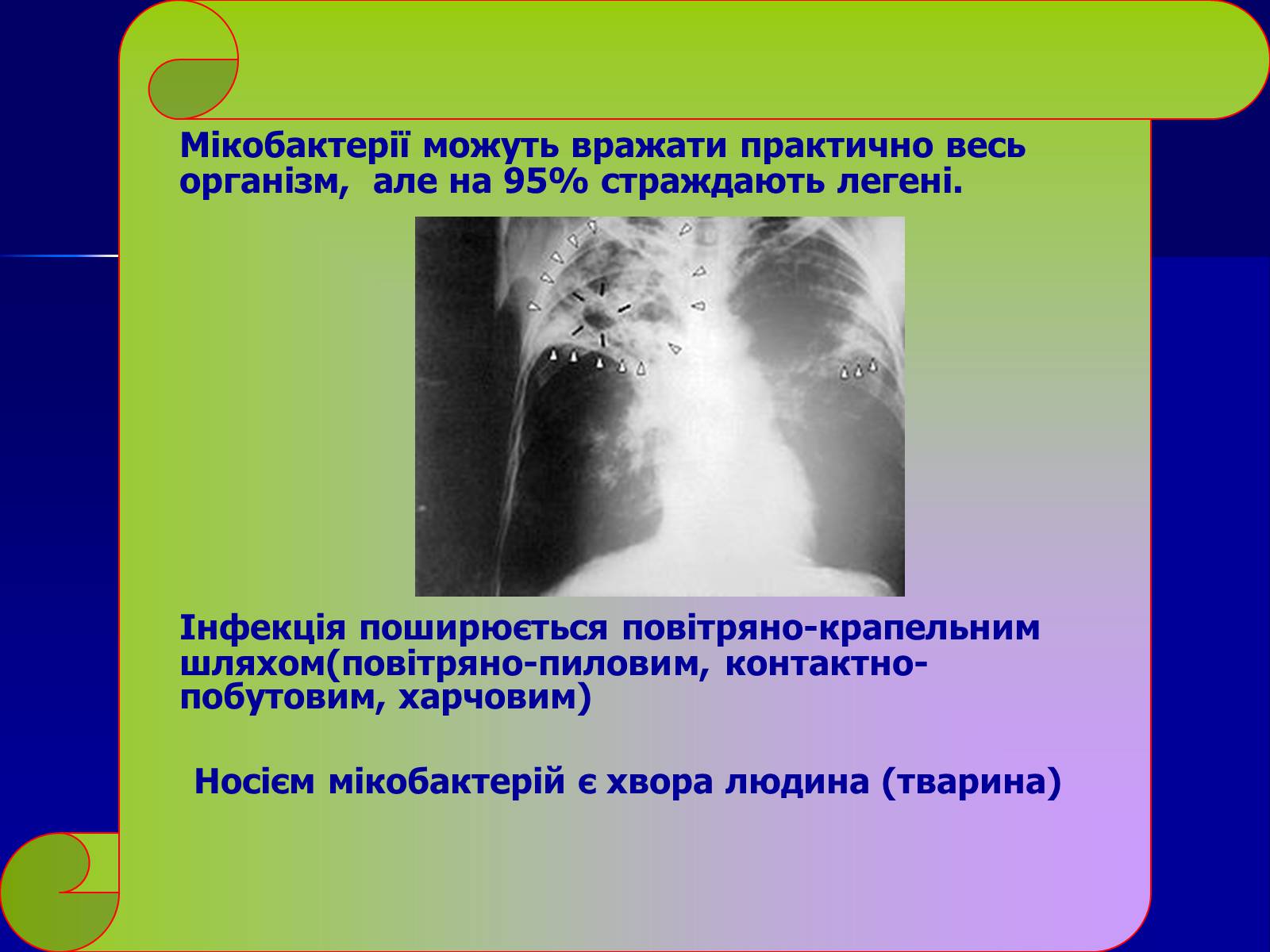 Презентація на тему «Інфекційні захворювання» (варіант 7) - Слайд #18