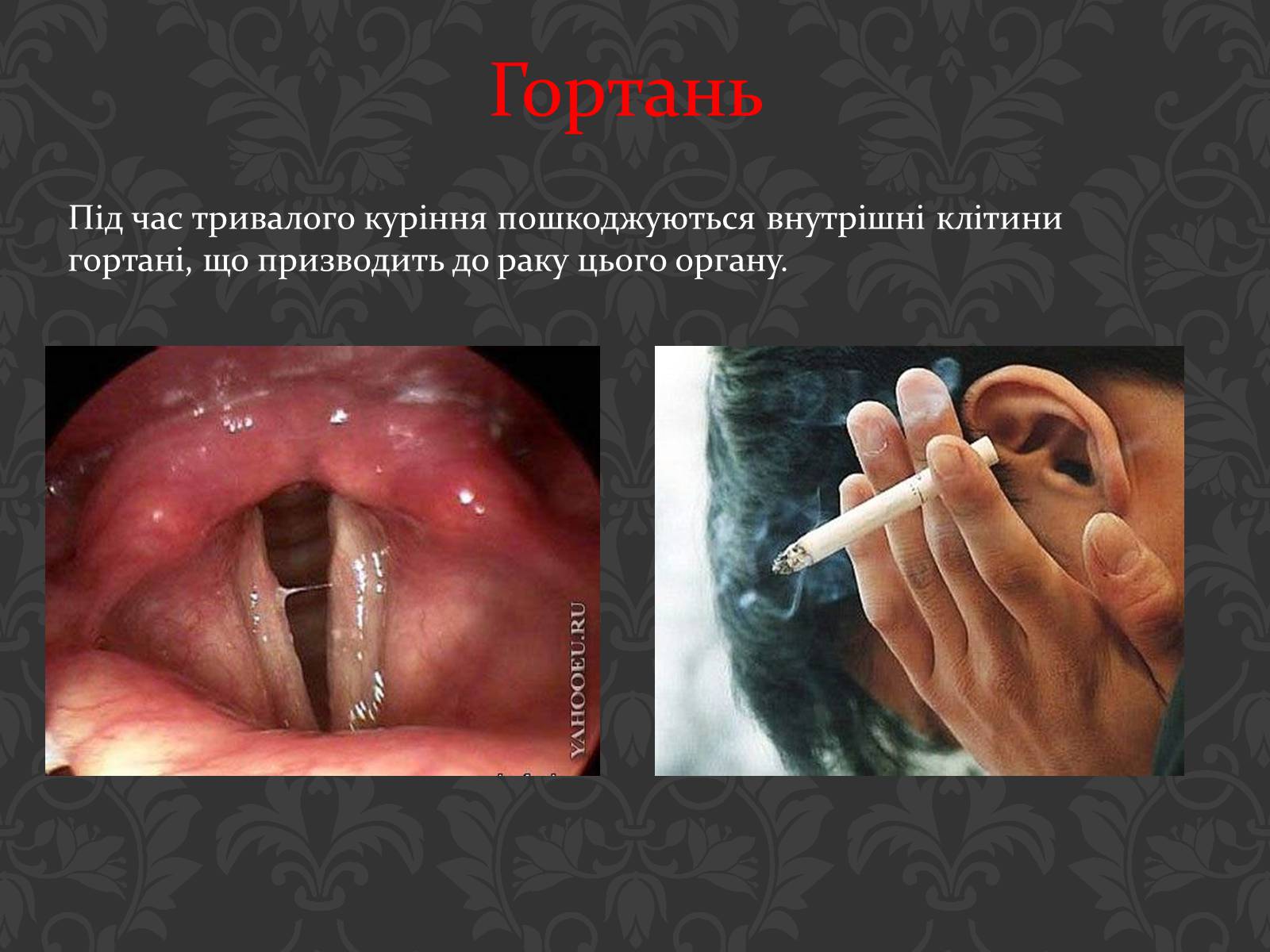 Презентація на тему «Вплив паління на організм людини» - Слайд #17