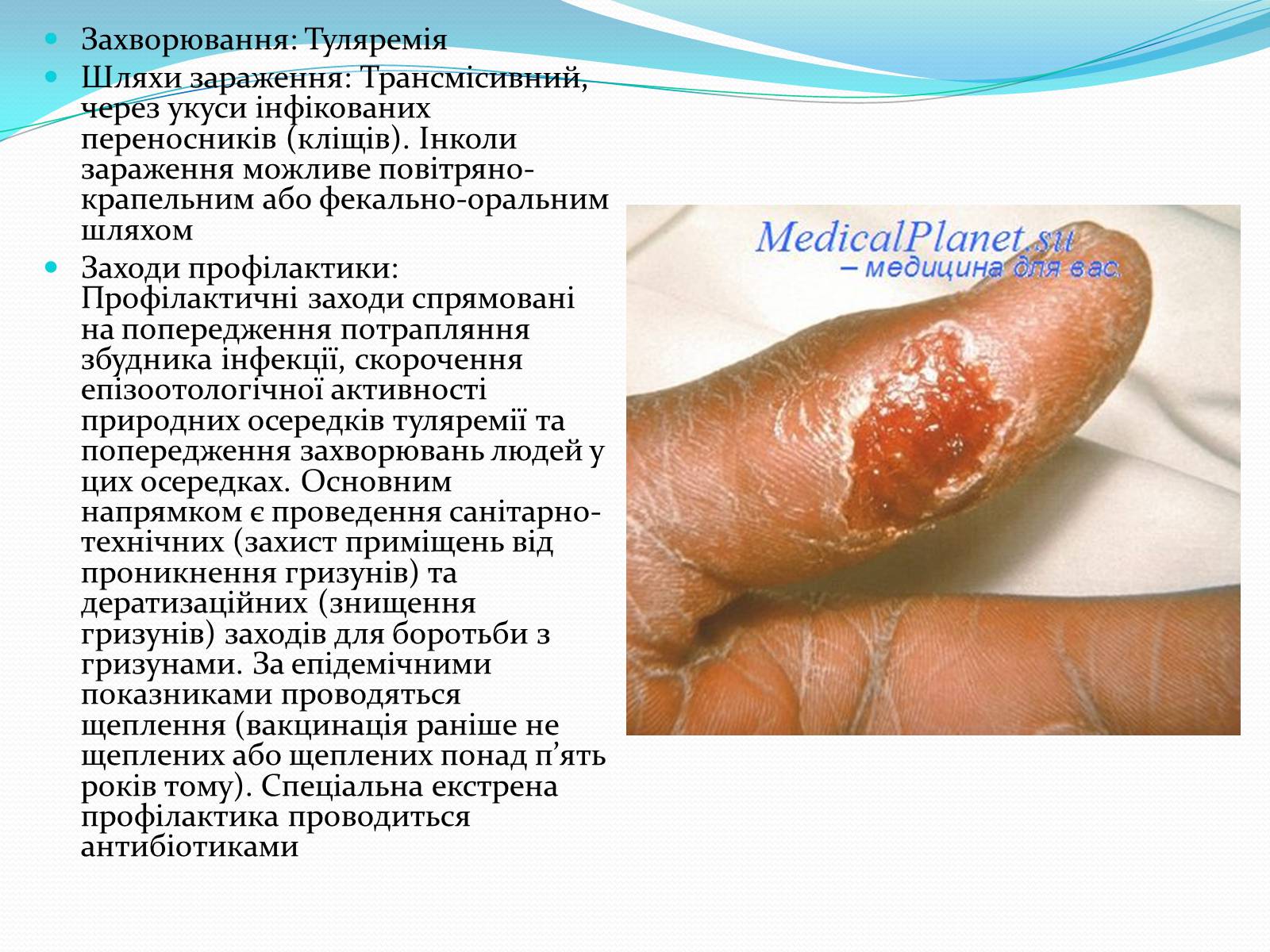 Презентація на тему «Профілактика бактеріальних захворювань людини» - Слайд #7