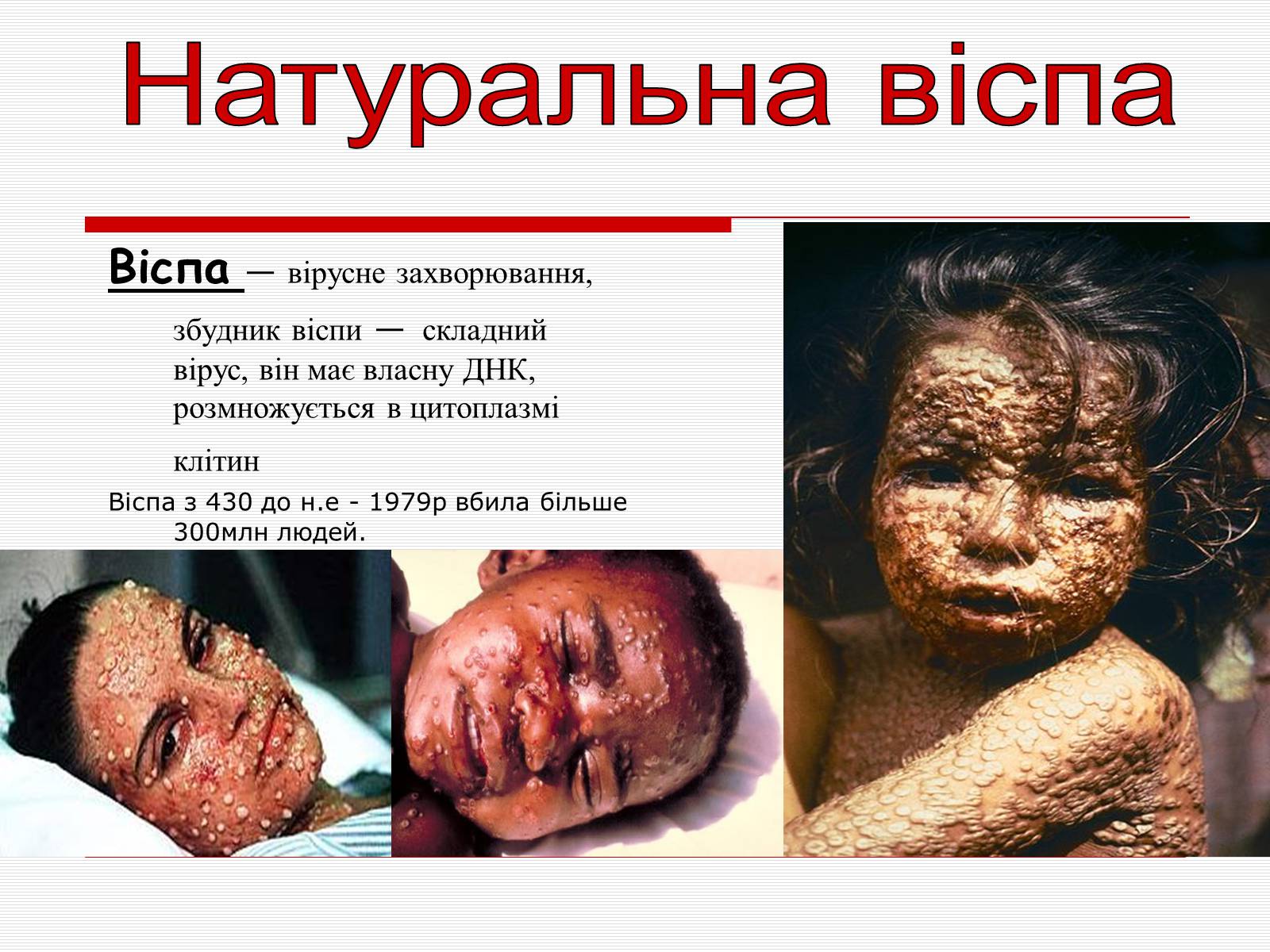 Презентація на тему «Найвизначніші хвороби людства» - Слайд #2