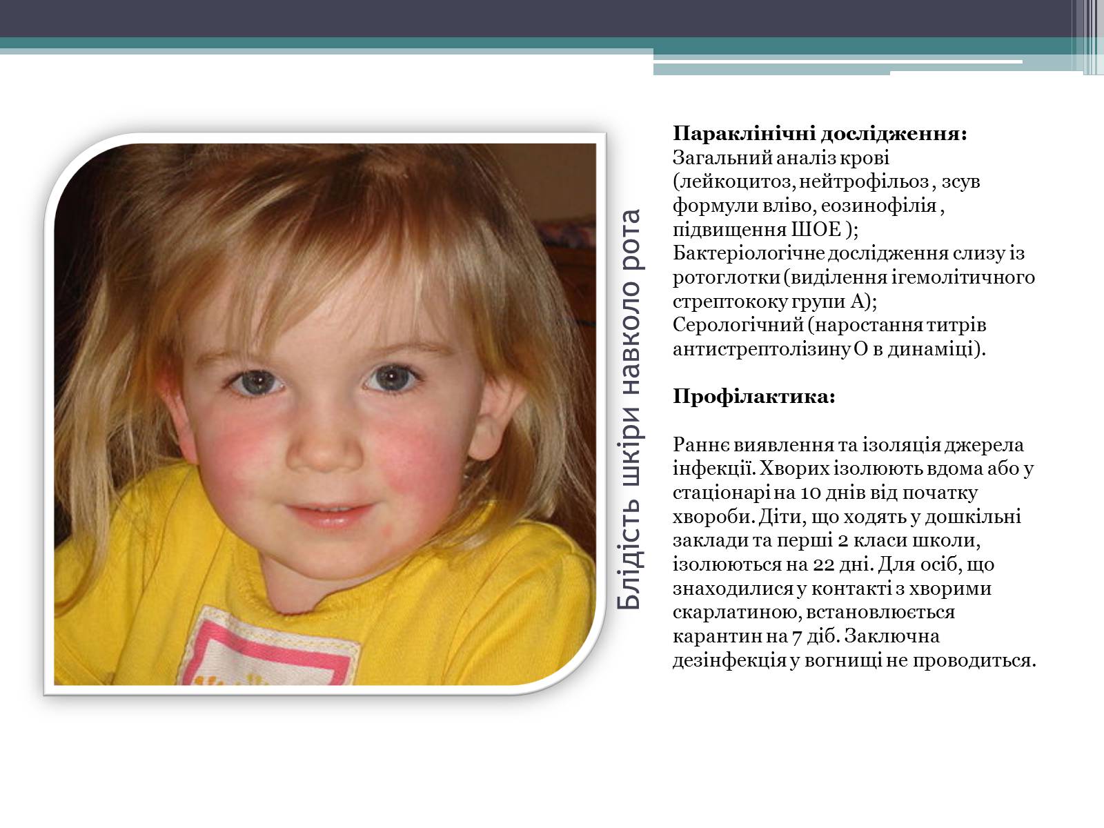 Презентація на тему «Дитячі інфекційні захворювання» - Слайд #7