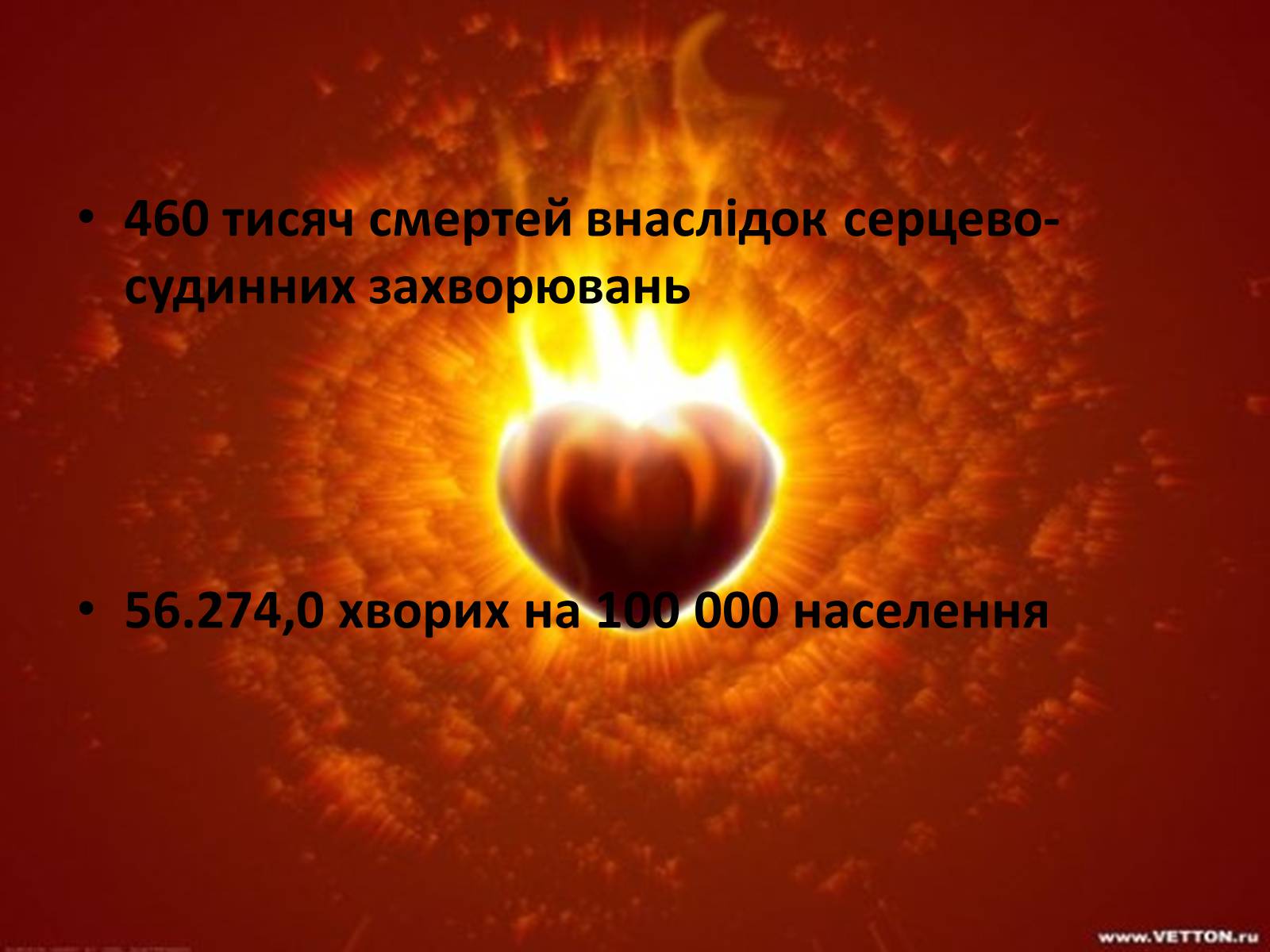 Презентація на тему «Найпоширеніші серцево-судинні захворюванняв Україні» - Слайд #2